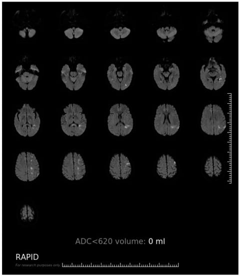 Brainsci 12 01451 g0a1