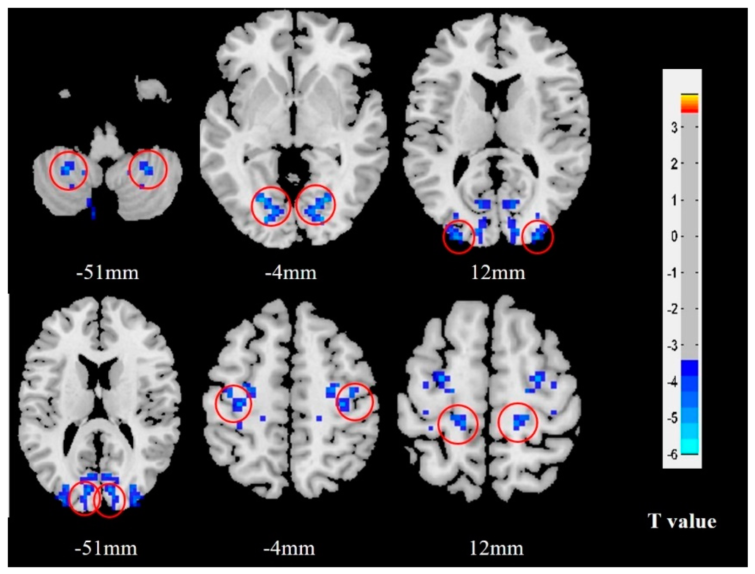 Brainsci 12 01505 g002