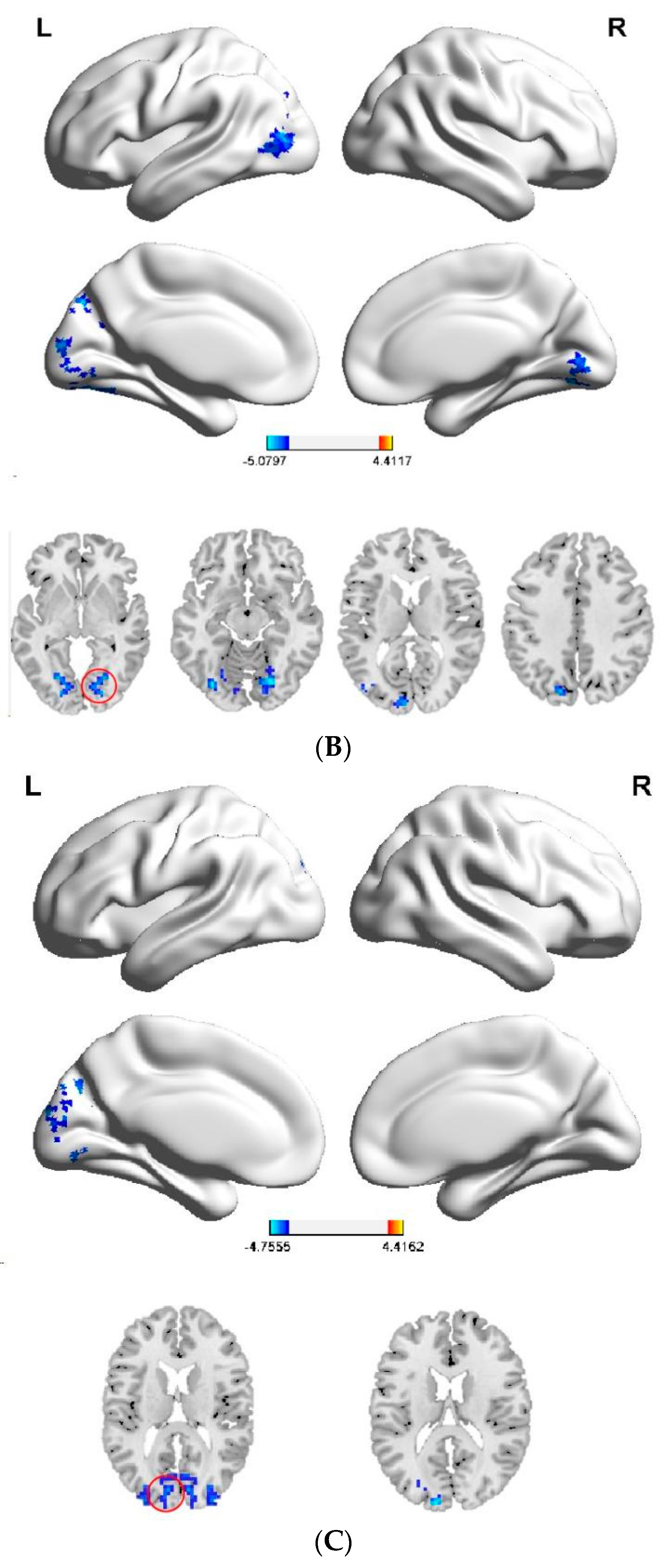 Brainsci 12 01505 g003b