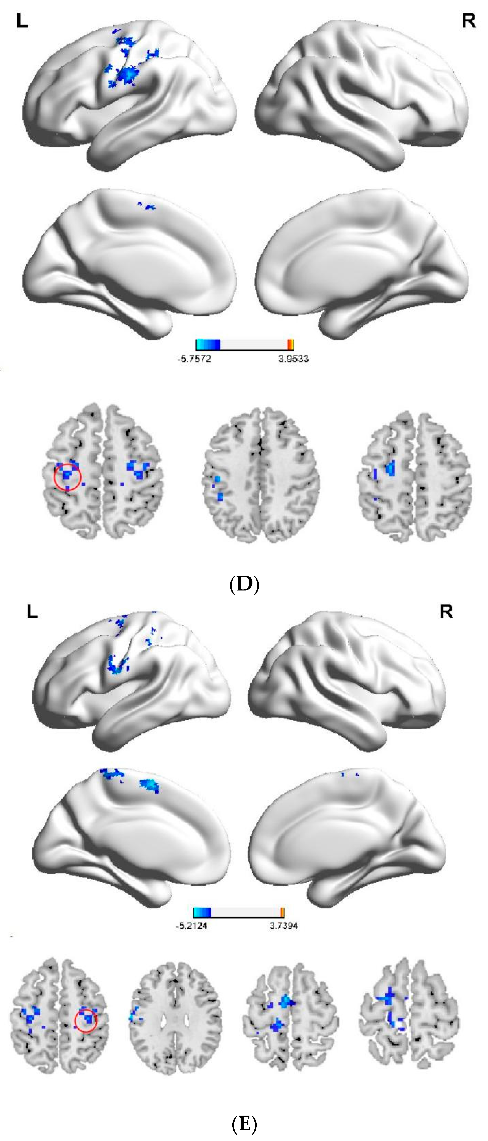 Brainsci 12 01505 g003c