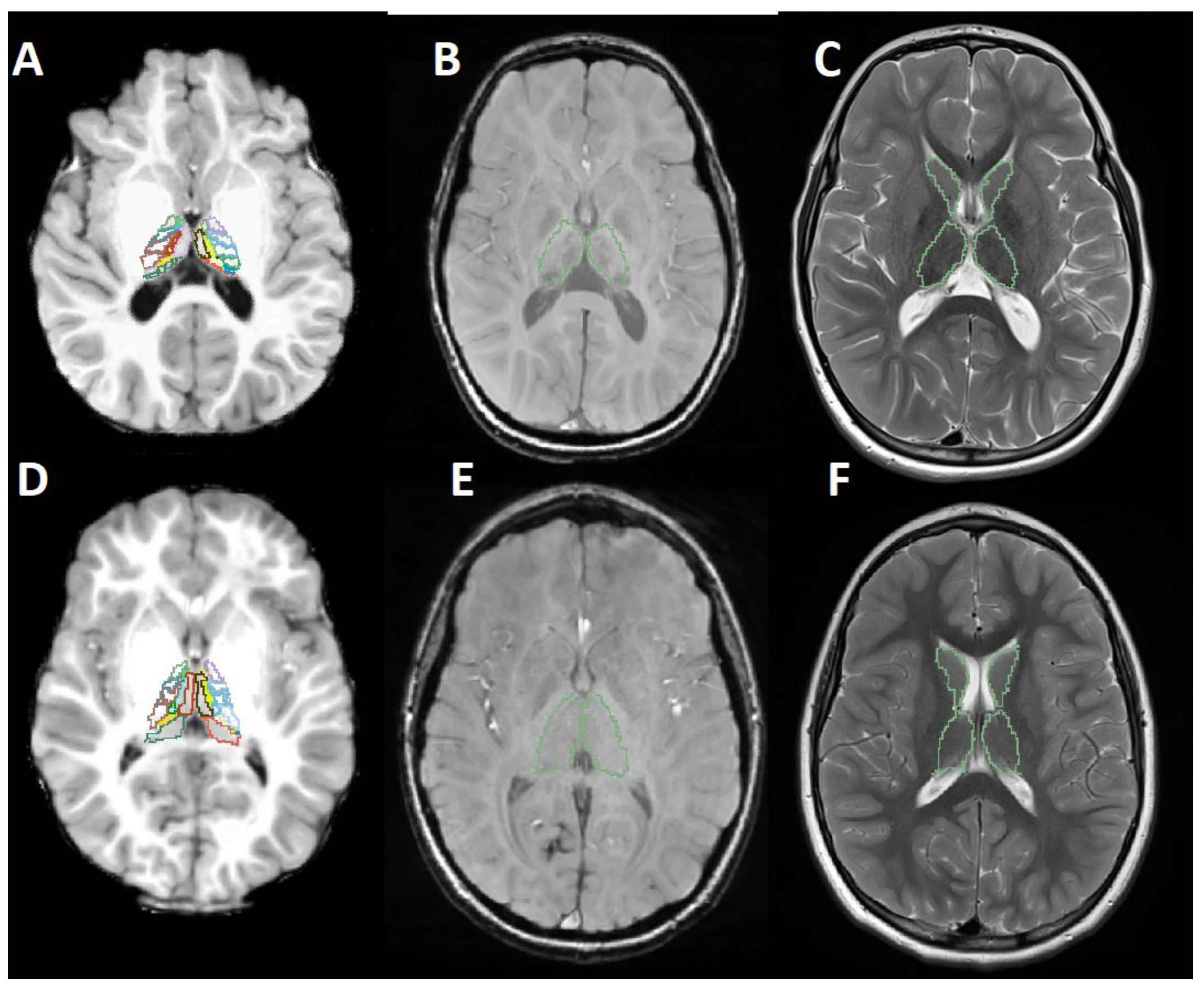 Brainsci 12 01522 g001