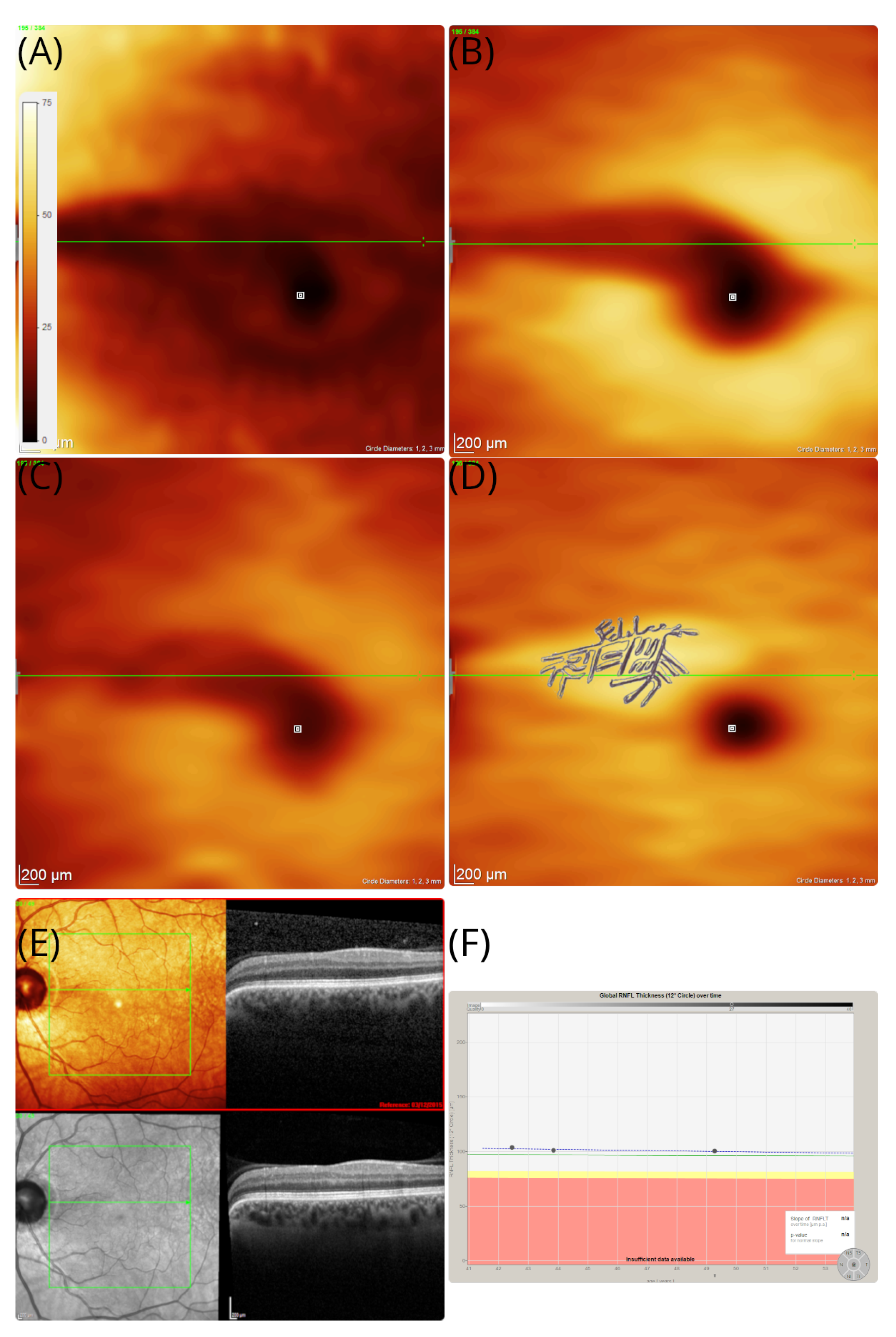 Brainsci 12 01542 g002 Brainsci 12 01542 g002