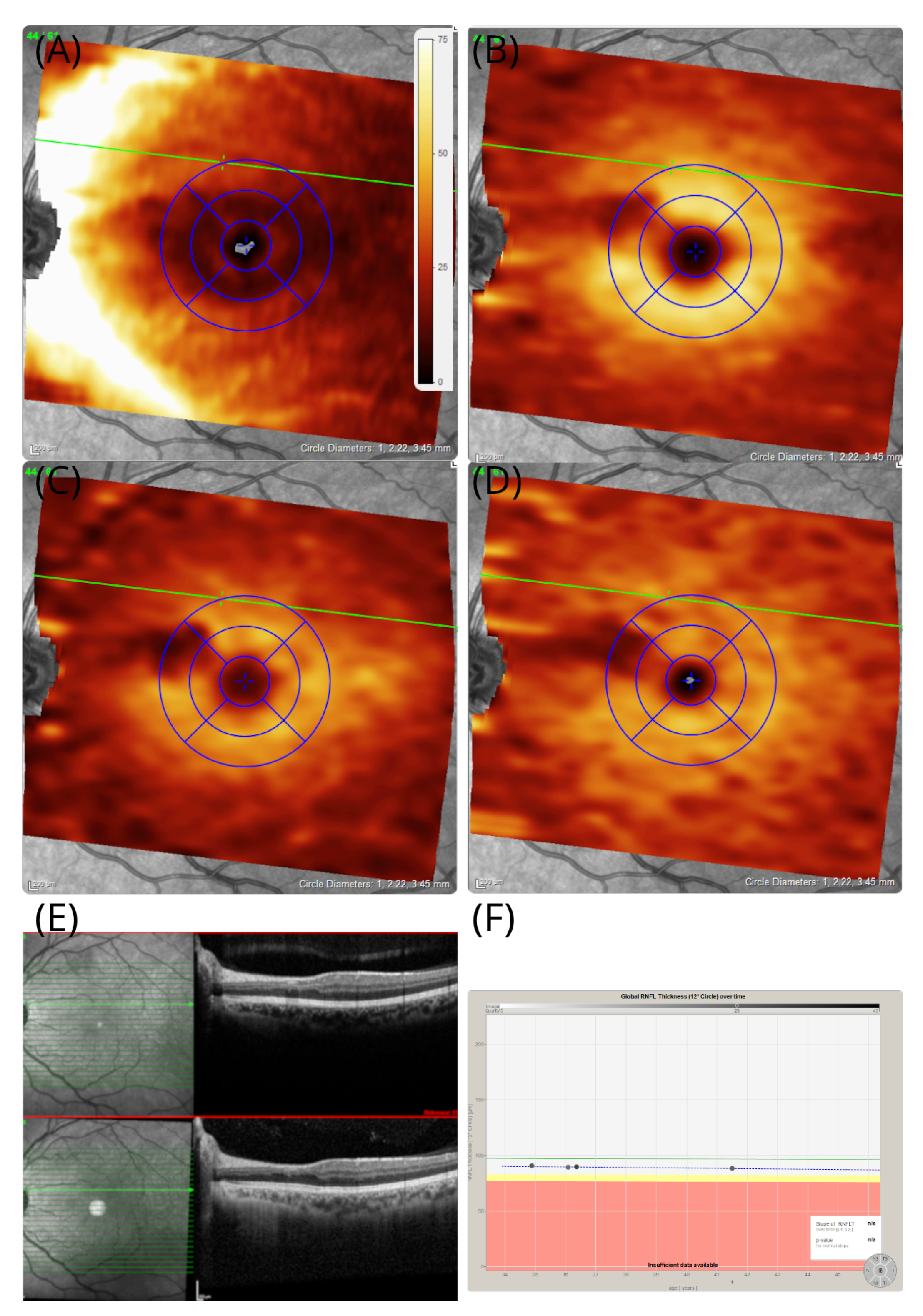Brainsci 12 01542 g005 Brainsci 12 01542 g005