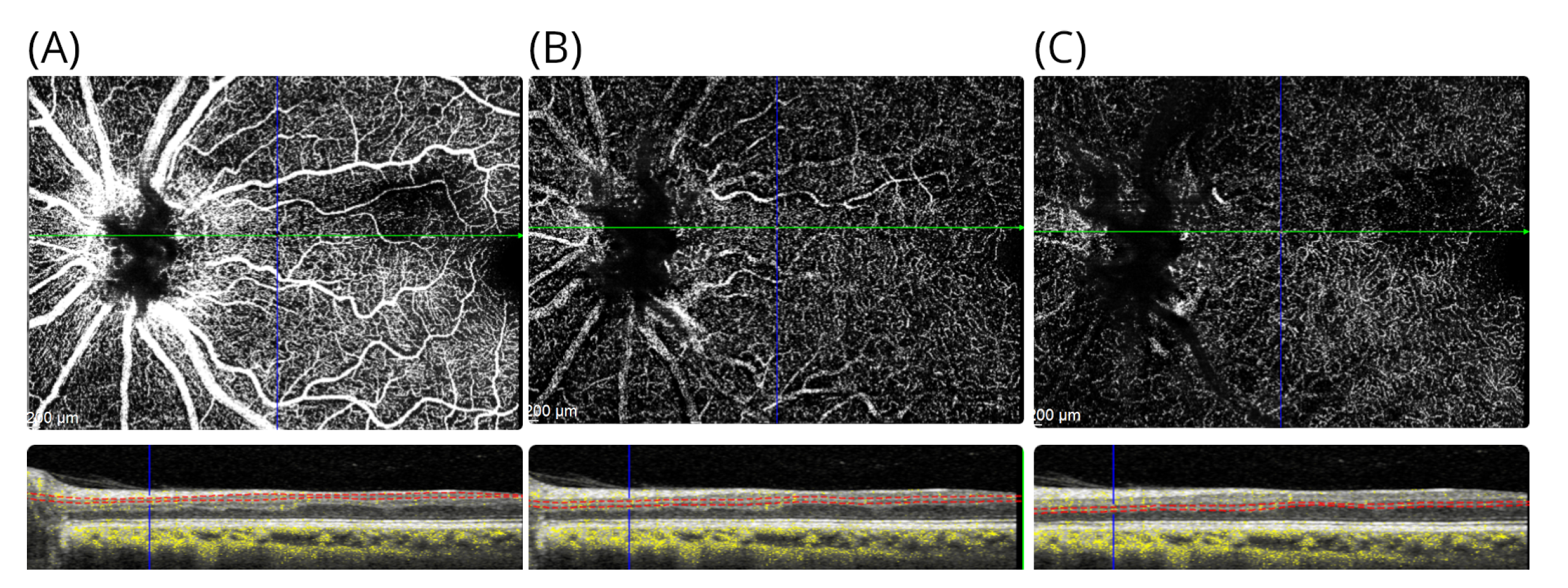 Brainsci 12 01542 g006 Brainsci 12 01542 g006