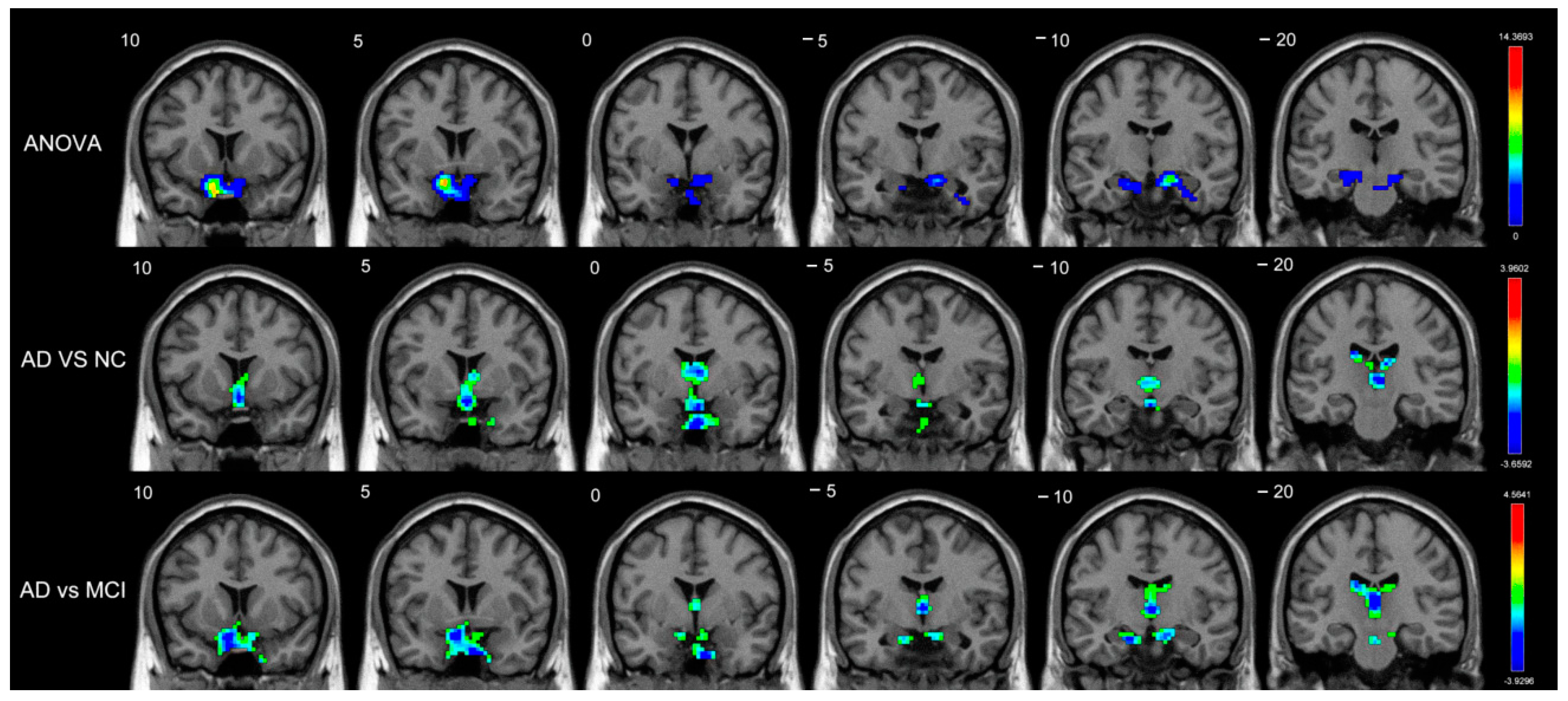 Brainsci 12 01555 g001