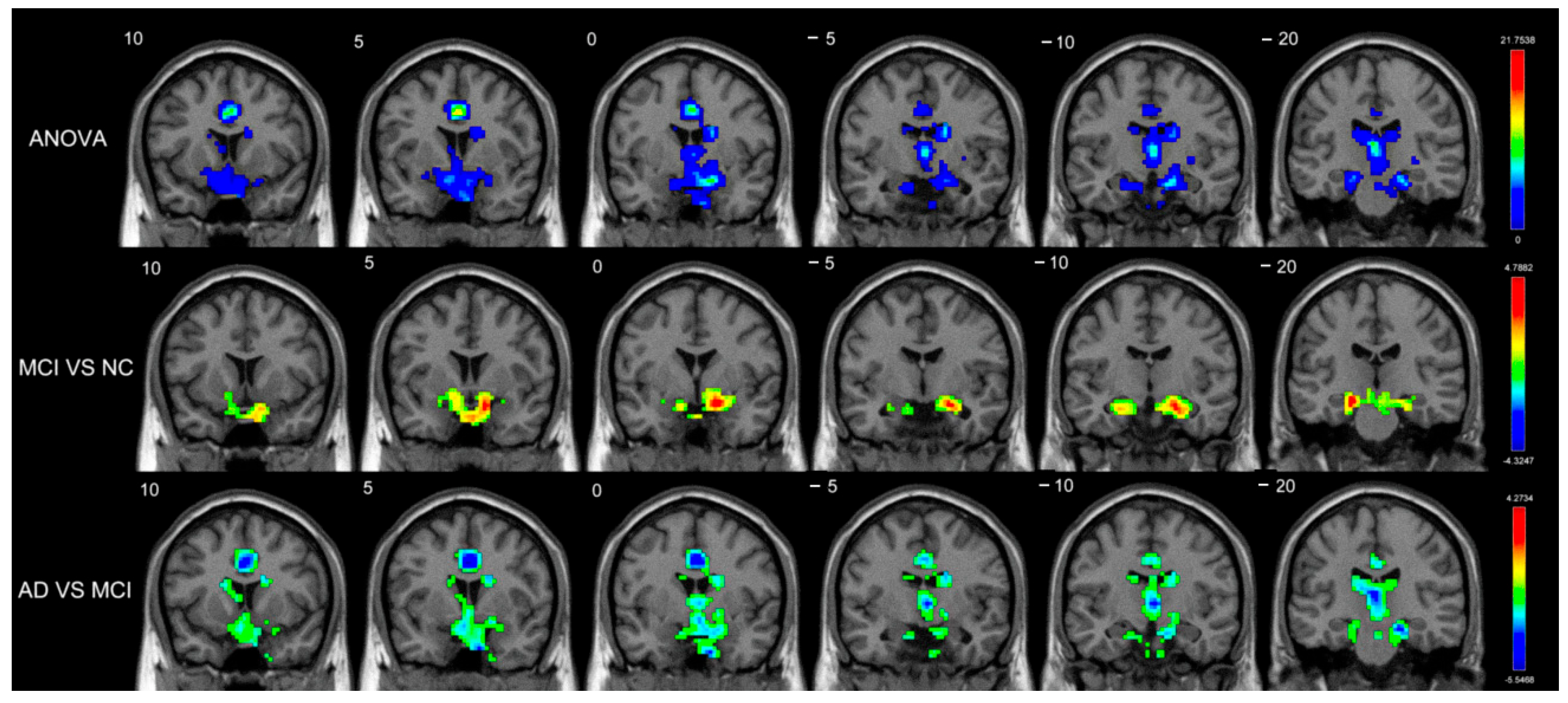 Brainsci 12 01555 g002