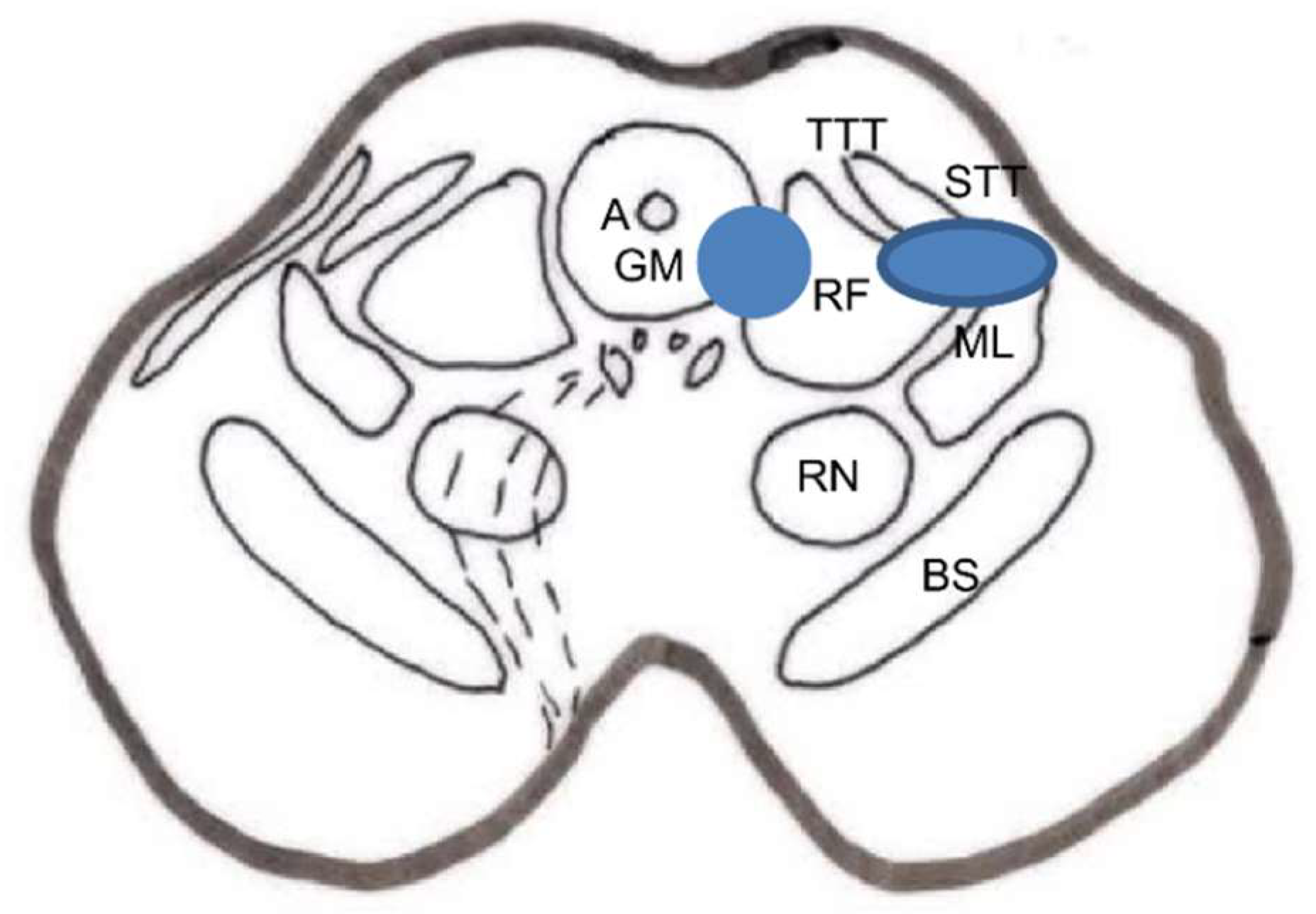 Brainsci 12 01584 g013 Brainsci 12 01584 g013