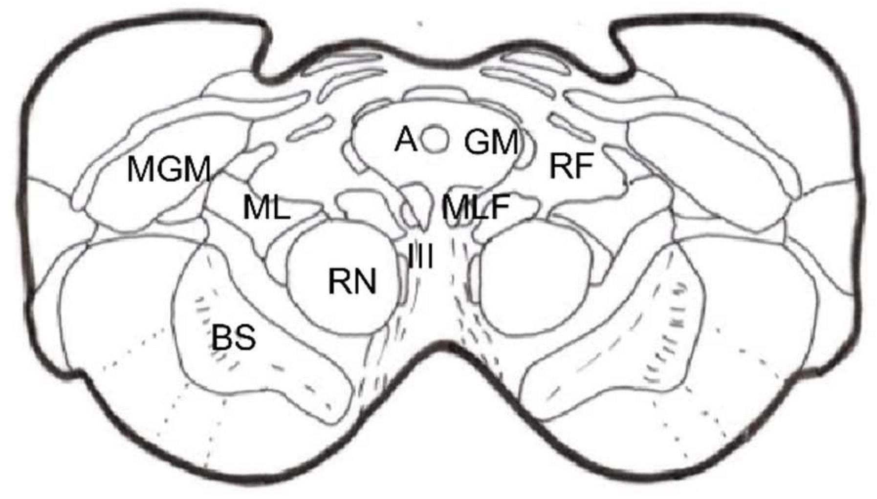 Brainsci 12 01584 g014 Brainsci 12 01584 g014
