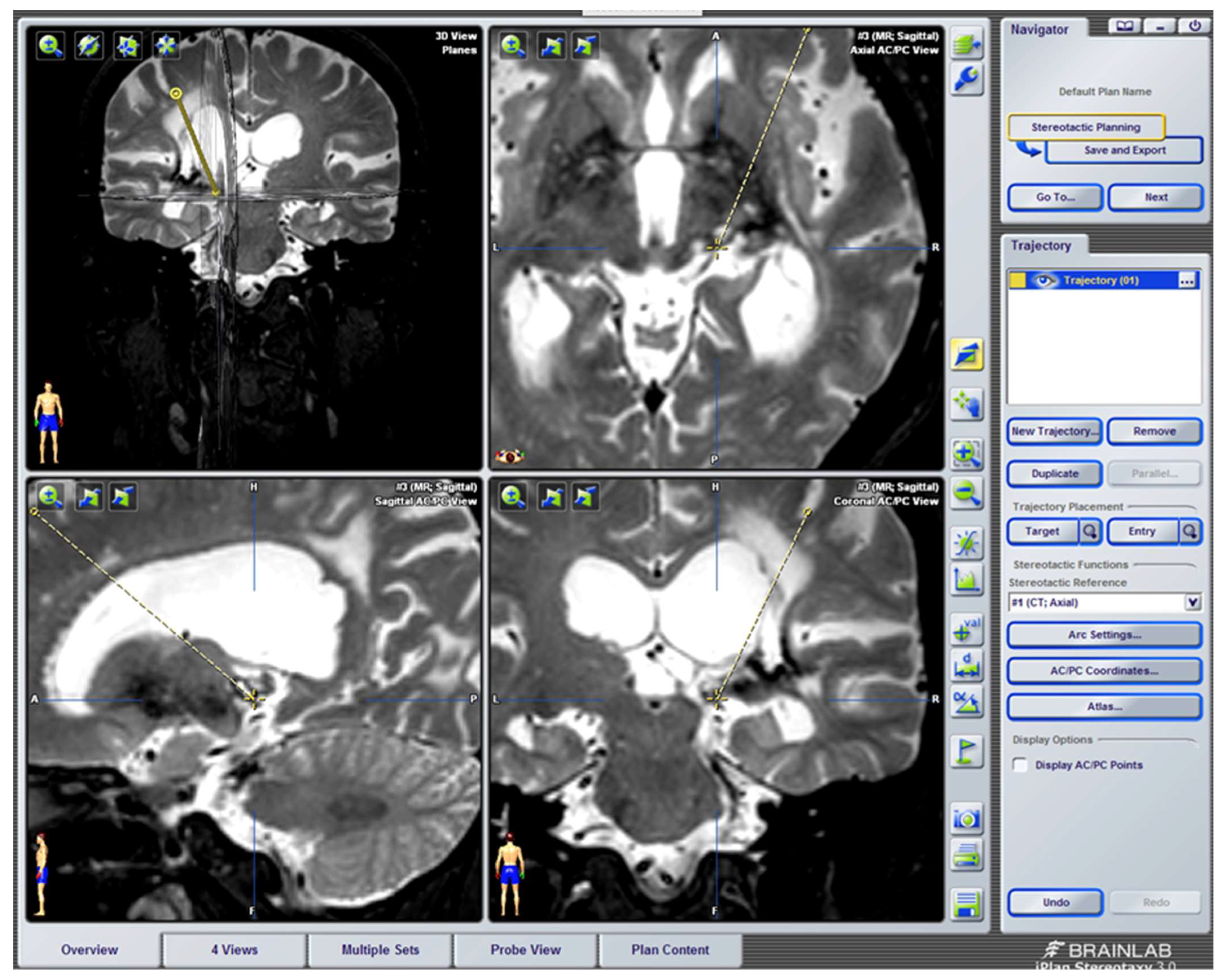 Brainsci 12 01584 g016 Brainsci 12 01584 g016