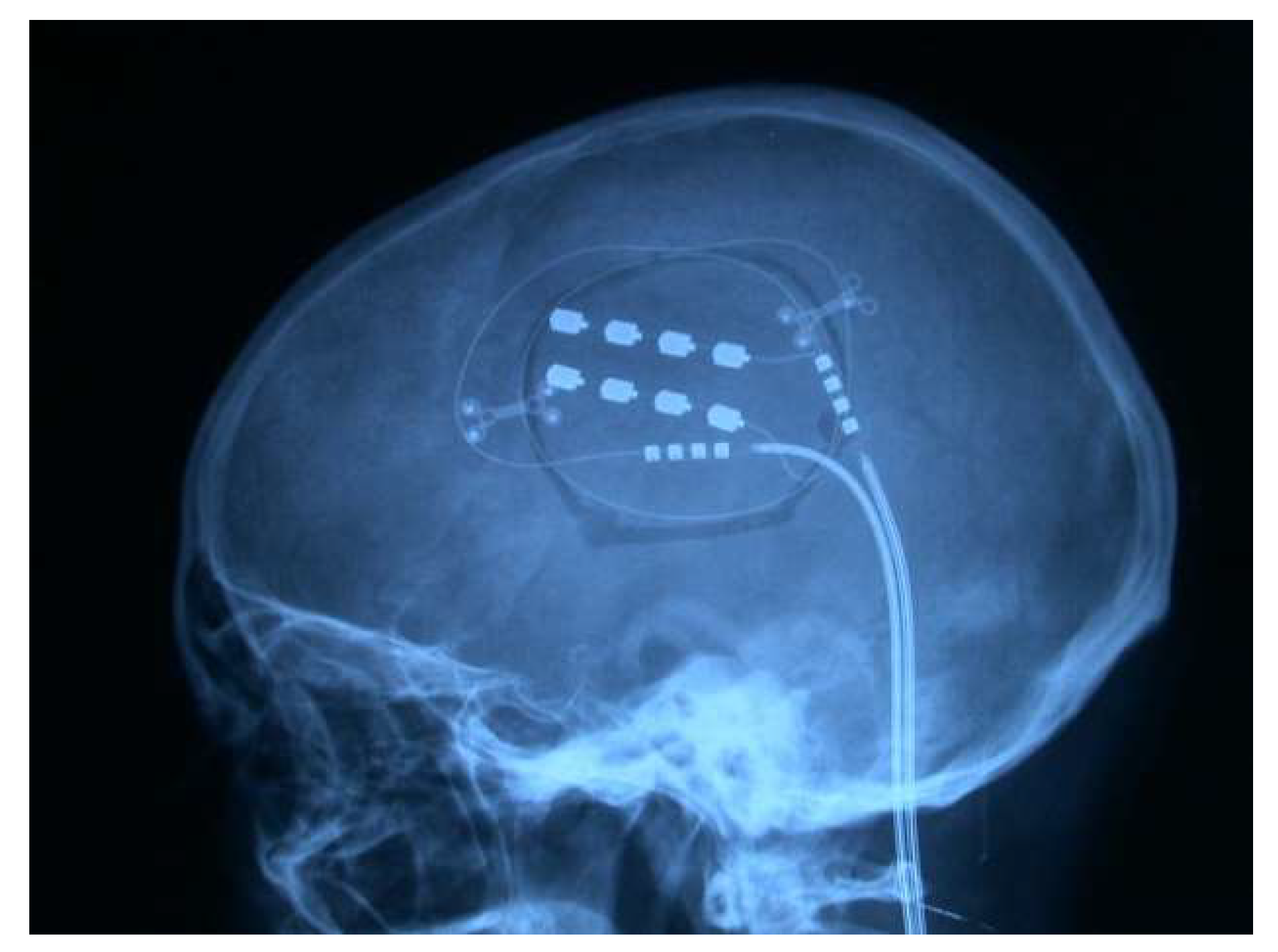 Brainsci 12 01584 g017 Brainsci 12 01584 g017