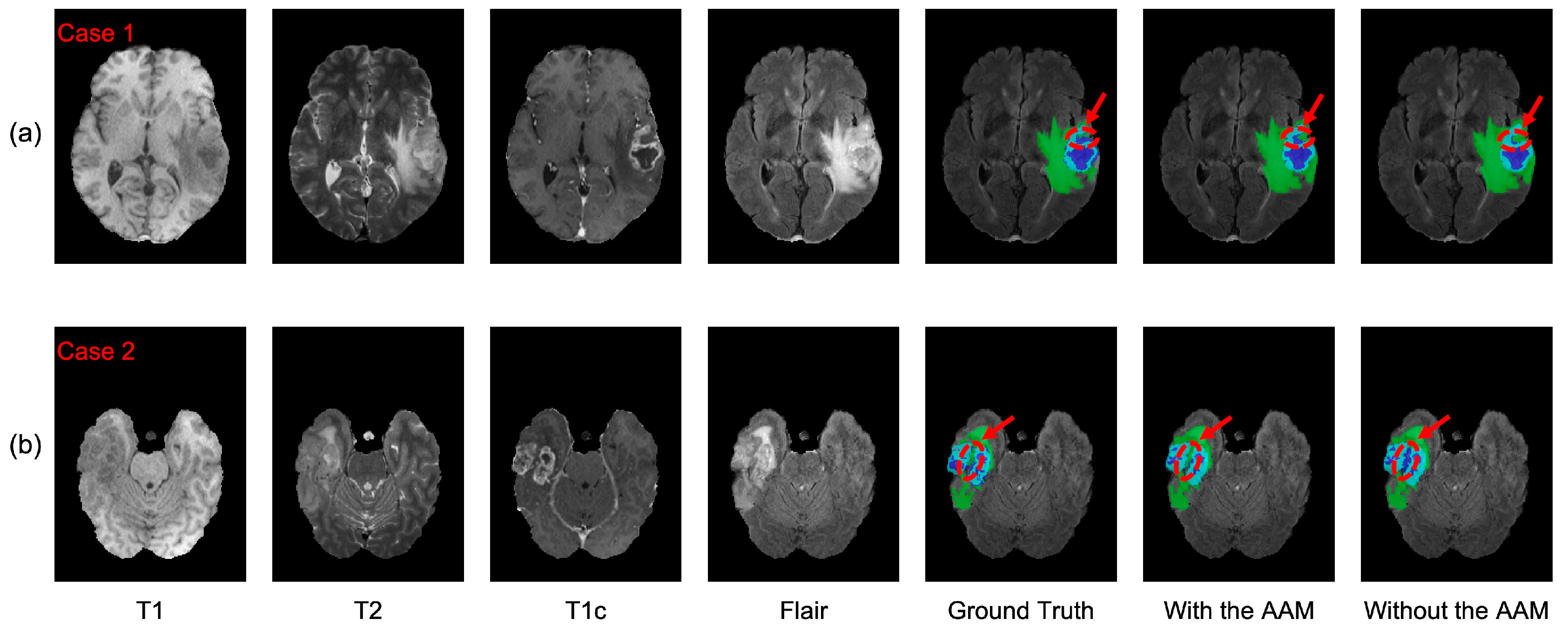 Brainsci 13 00012 g007