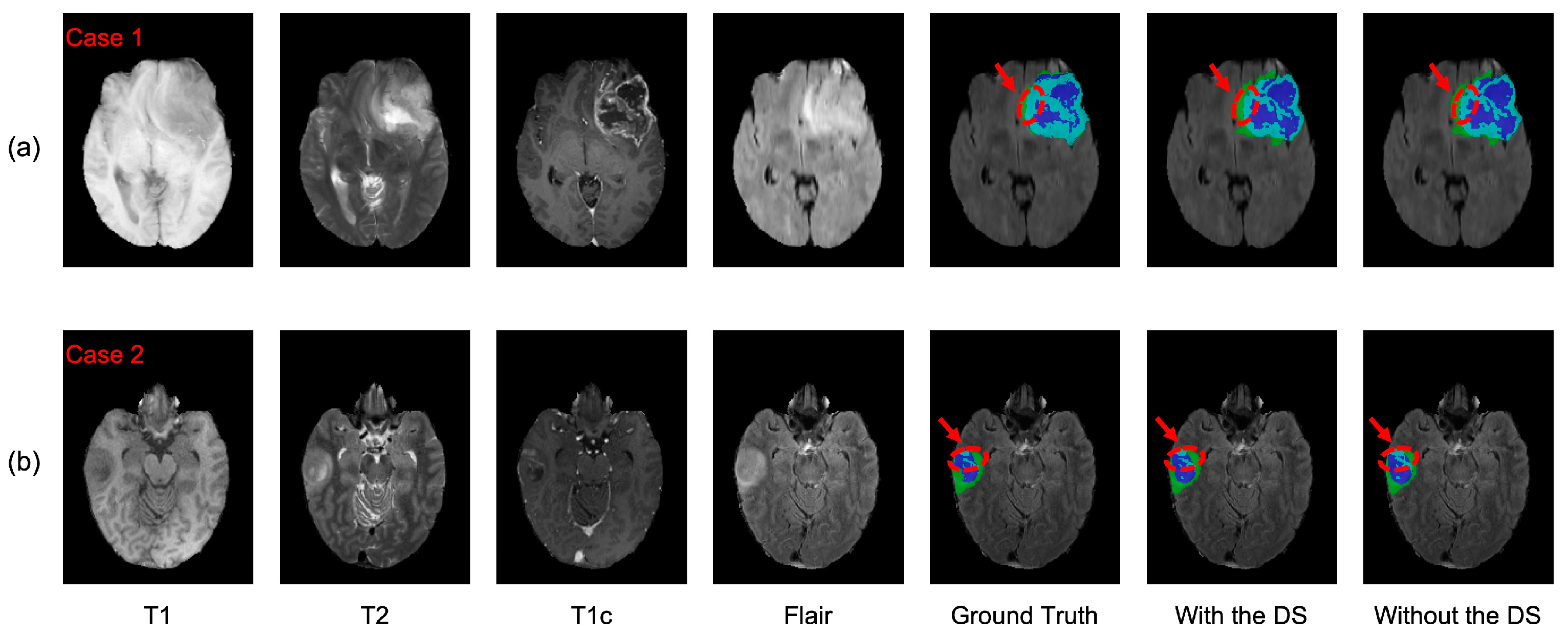 Brainsci 13 00012 g010