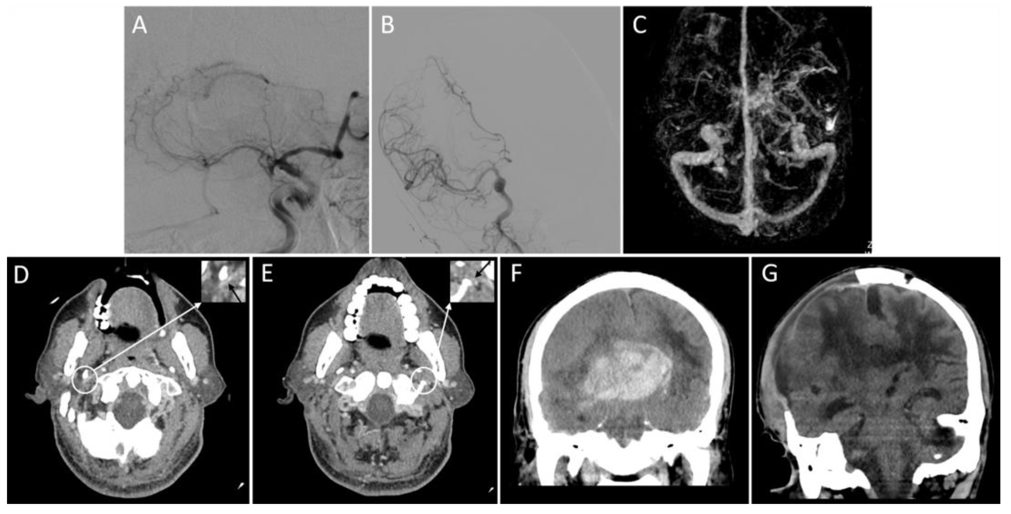 Brainsci 13 00032 g003