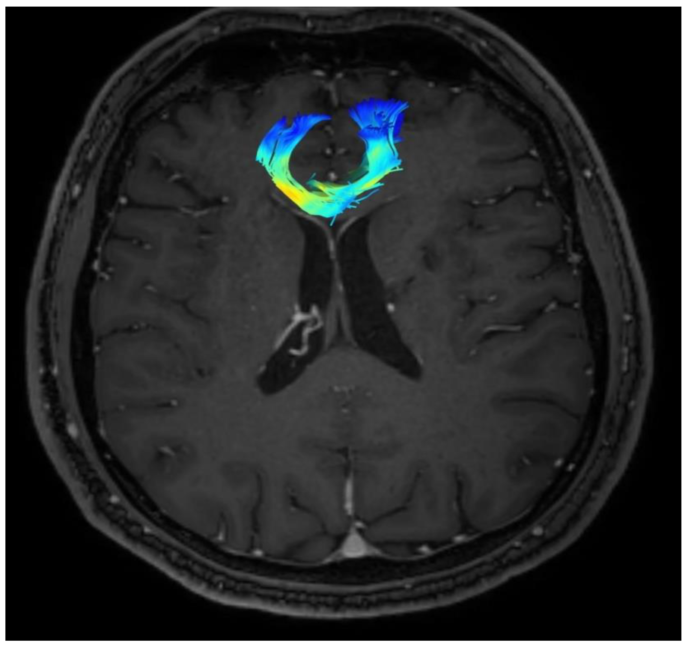 Brainsci 13 00044 g003