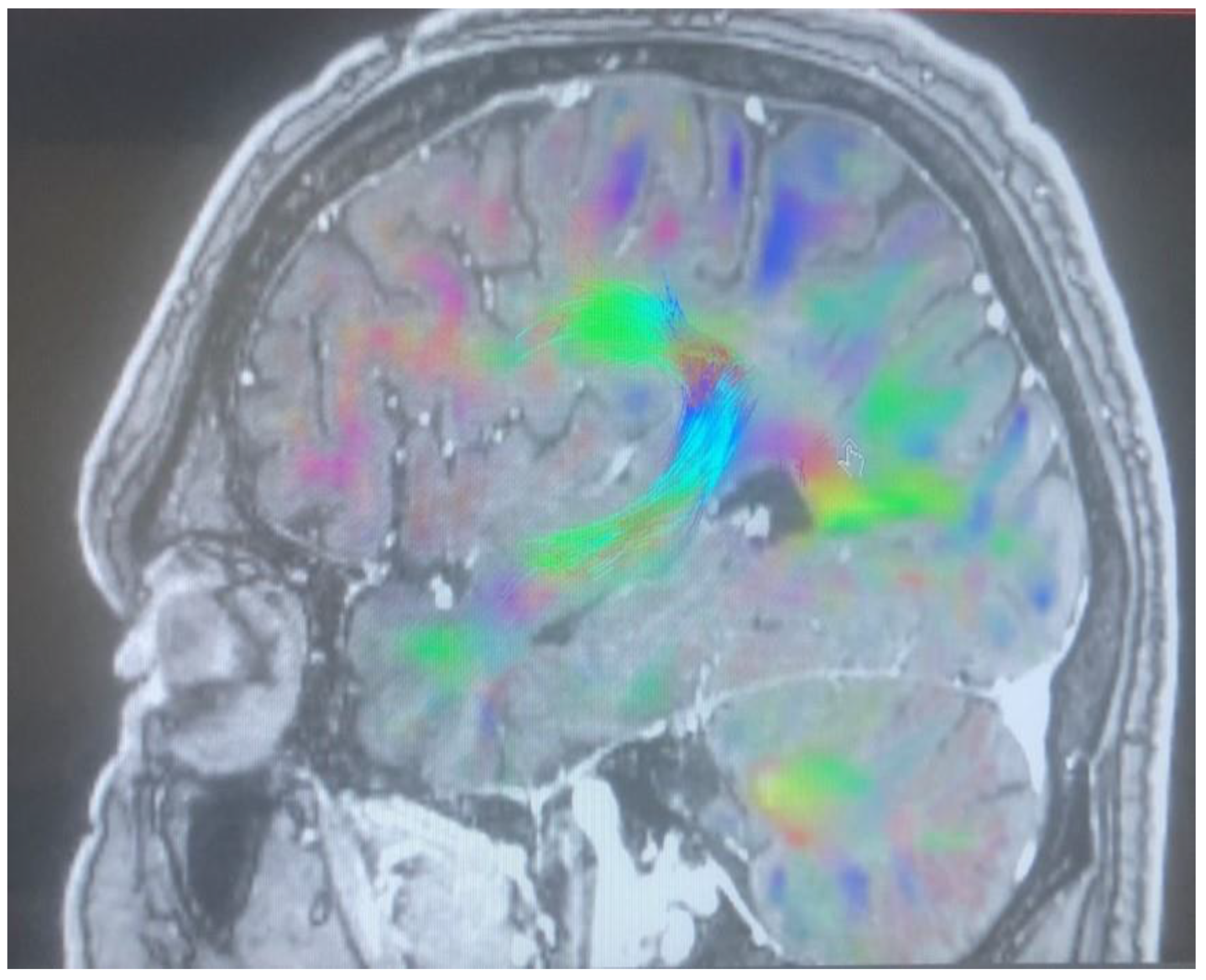 Brainsci 13 00044 g004