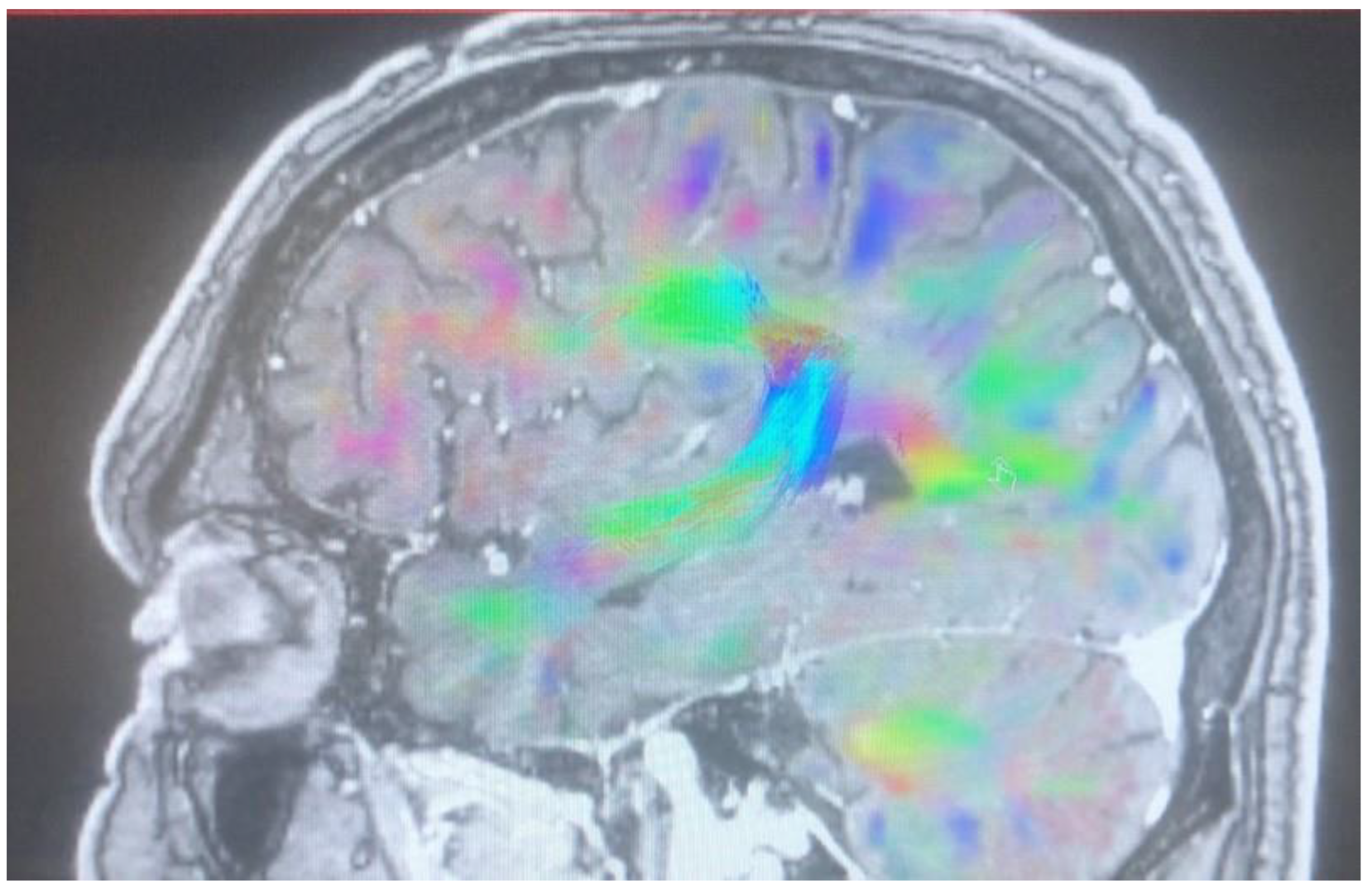 Brainsci 13 00044 g005