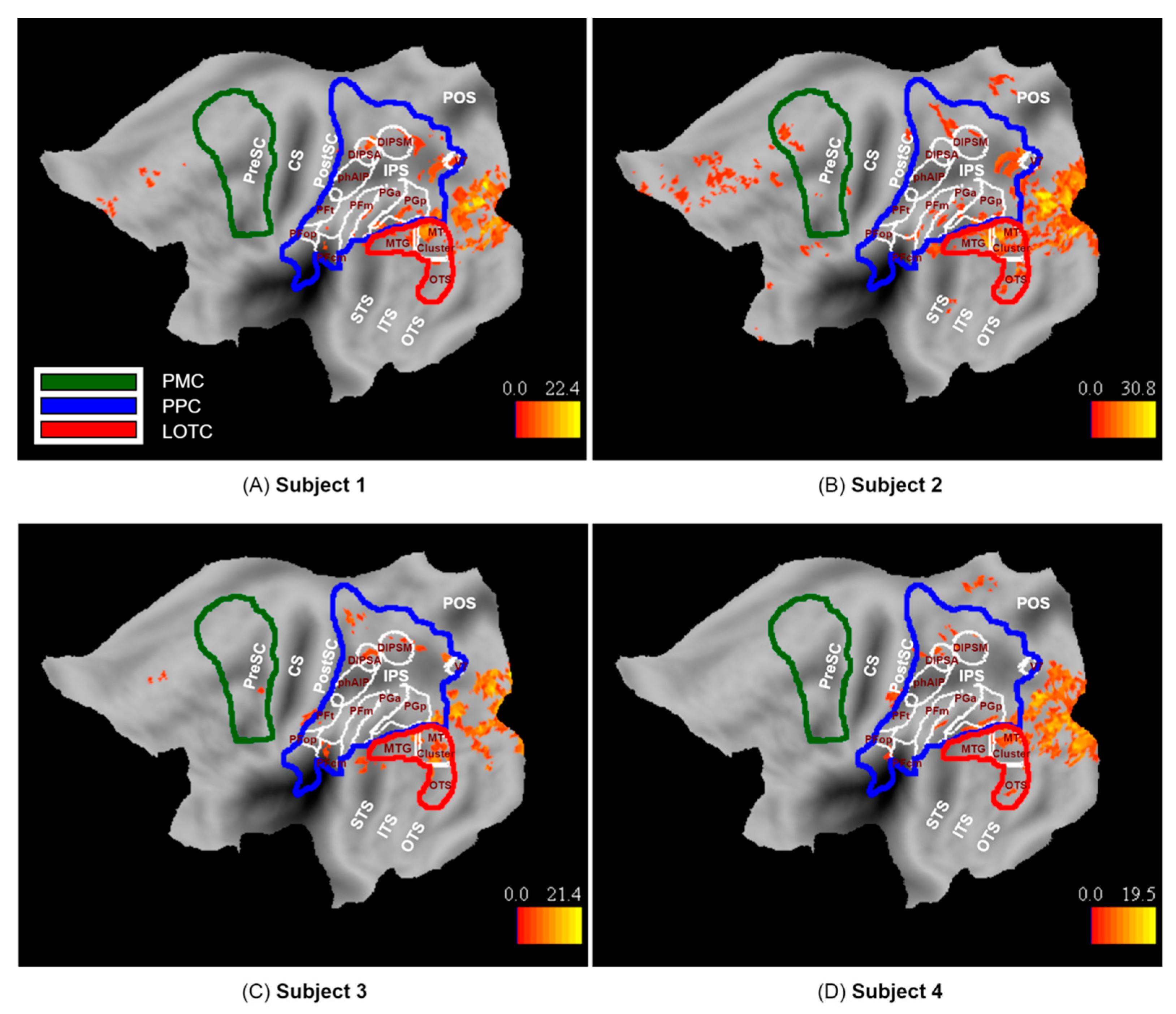 Brainsci 13 00061 g006