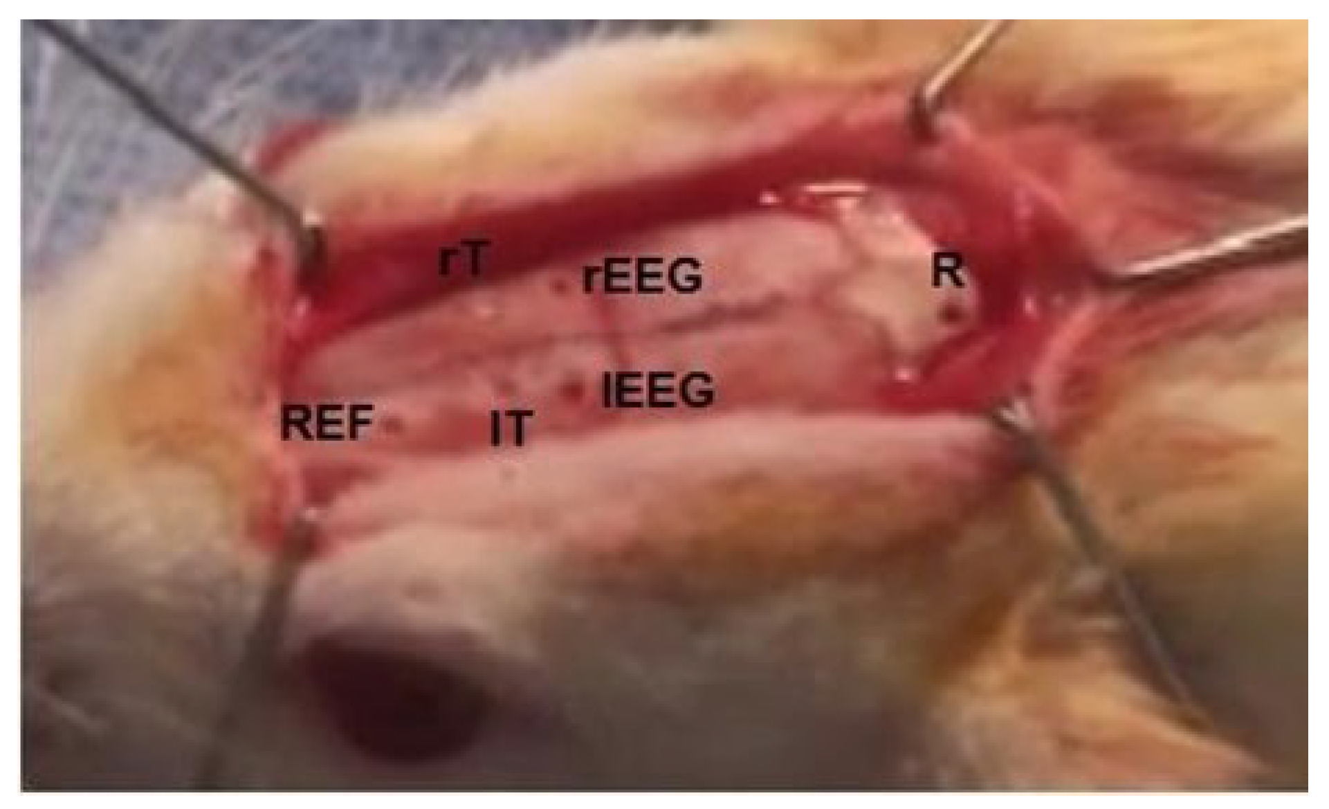 Brainsci 13 00072 g001