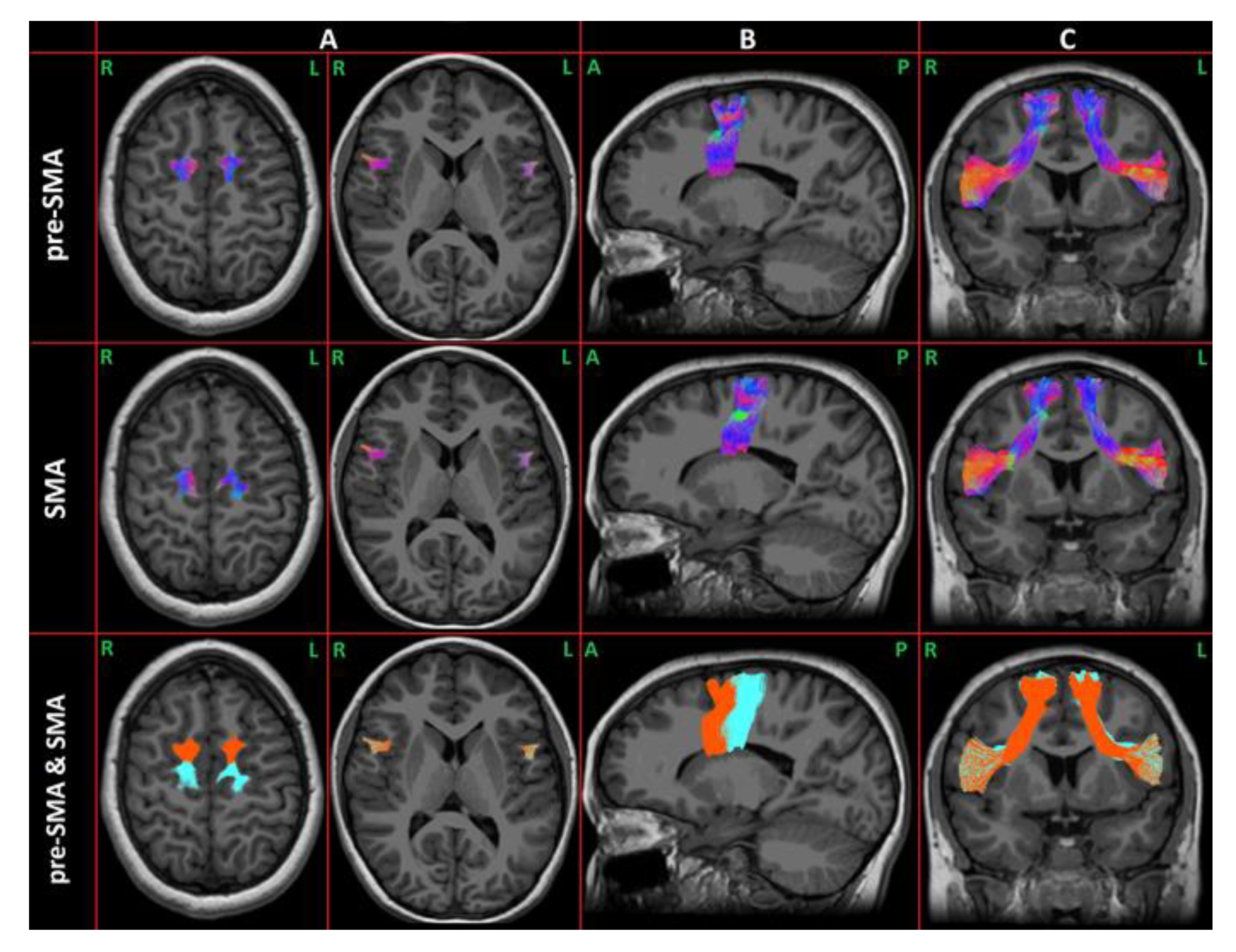Brainsci 13 00078 g002 Brainsci 13 00078 g002