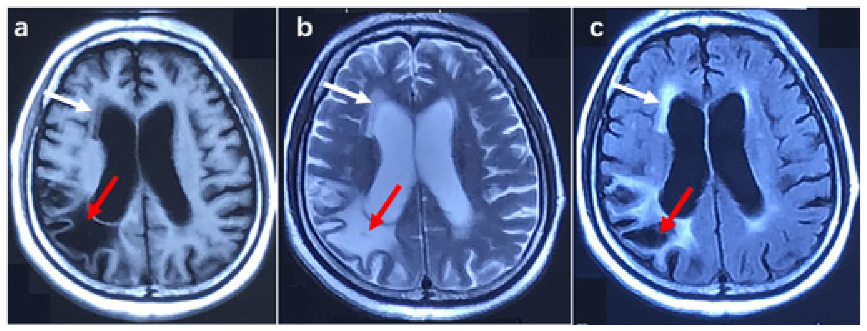 Brainsci 13 00085 g003