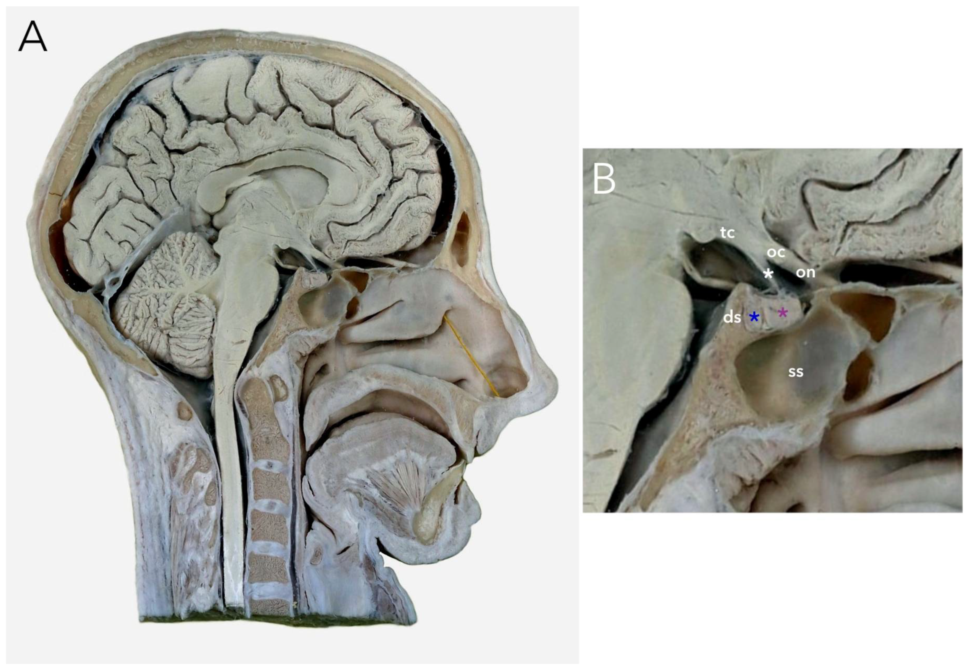 Brainsci 13 00089 g003