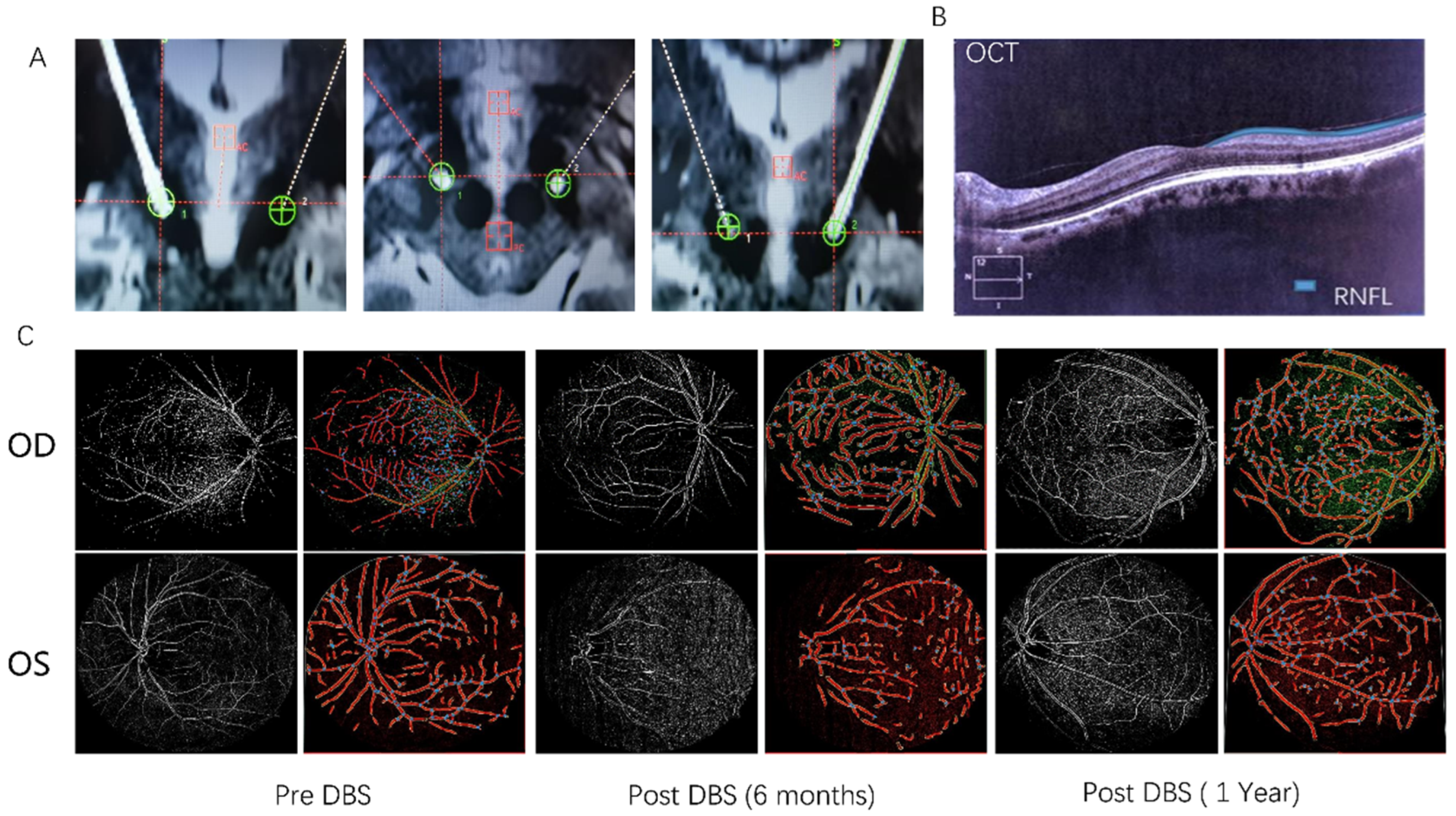 Brainsci 13 00103 g001