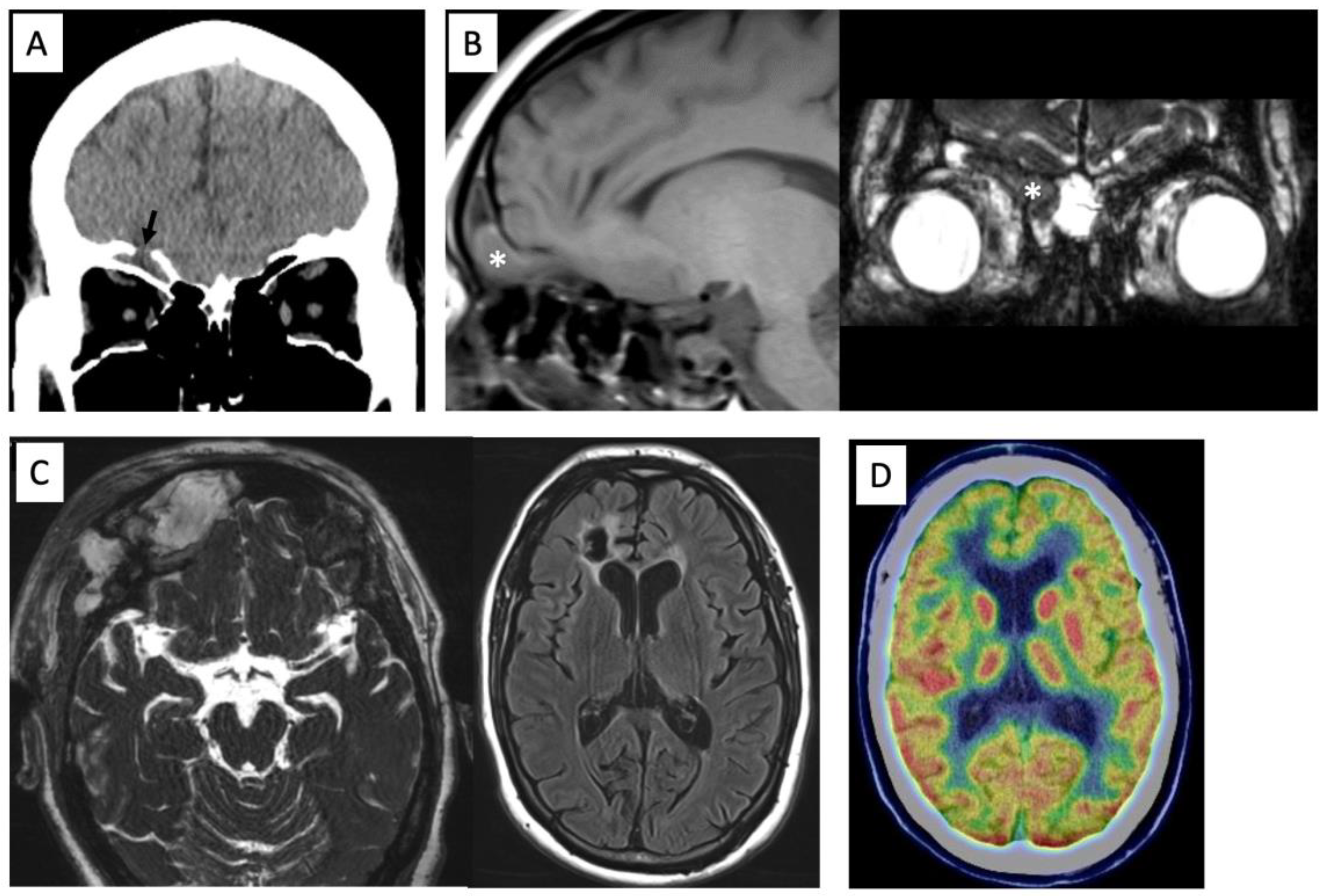 Brainsci 13 00115 g001