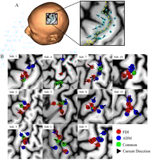 Brainsci 13 00116 g0a1