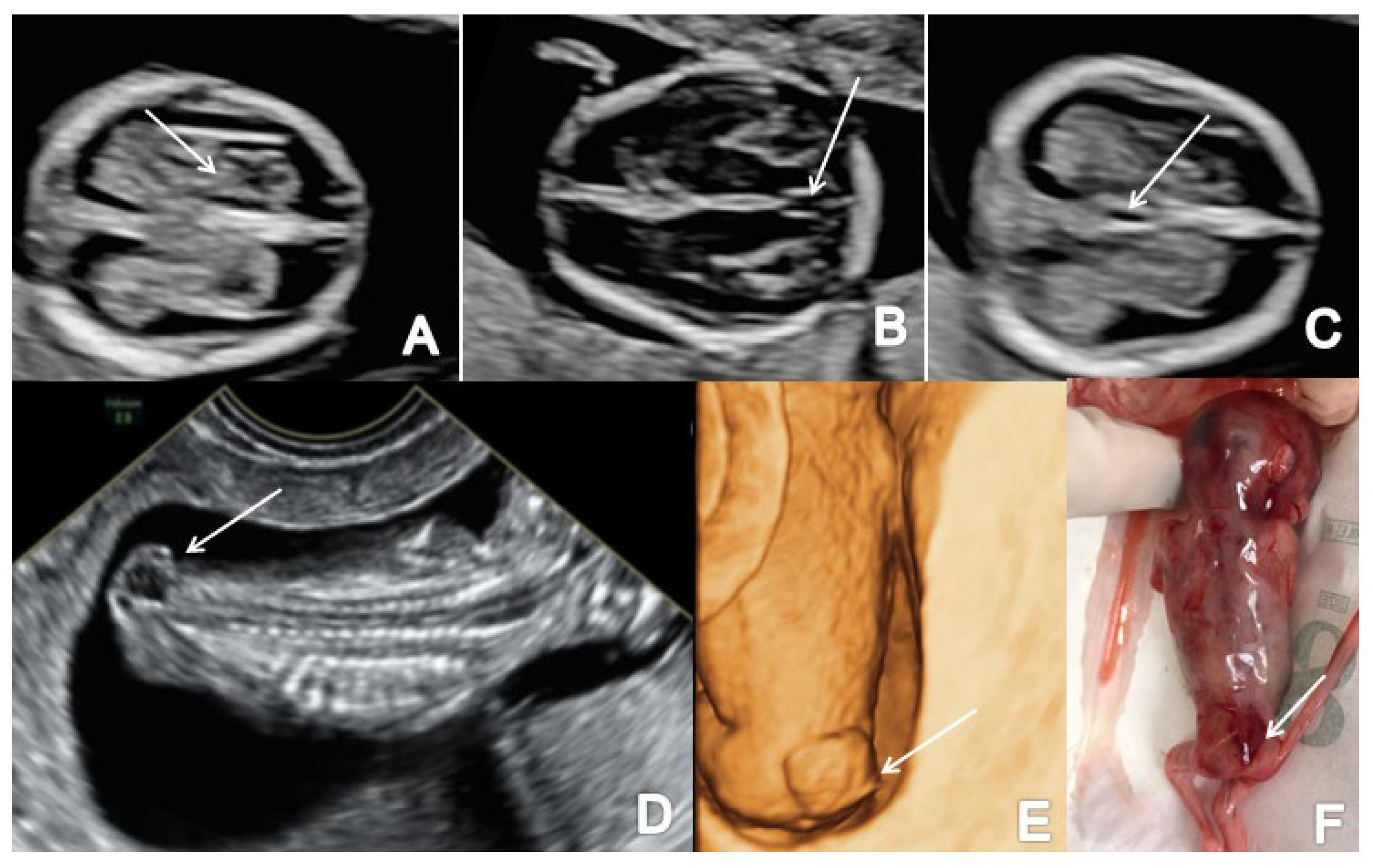 Brainsci 13 00118 g004
