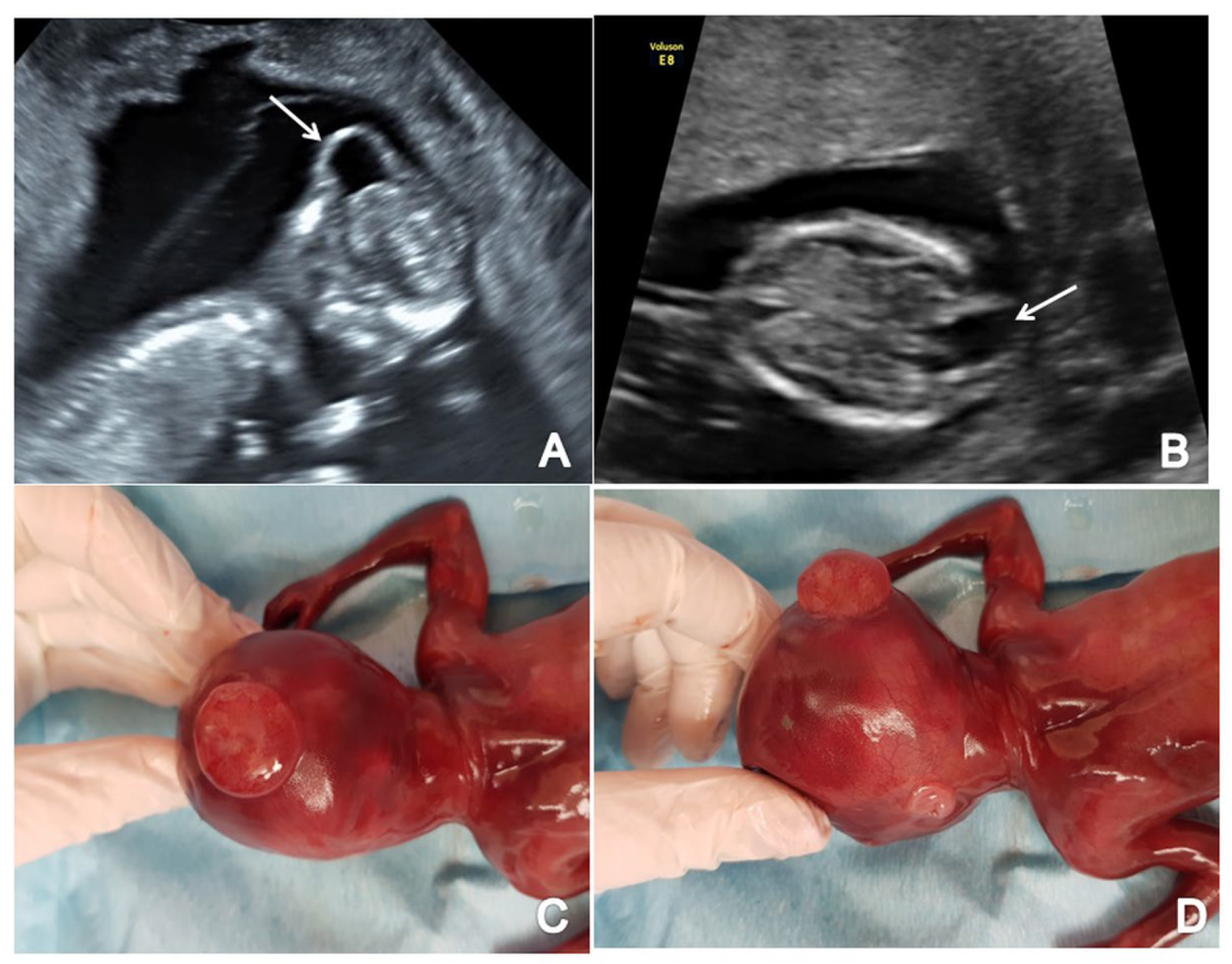 Brainsci 13 00118 g005