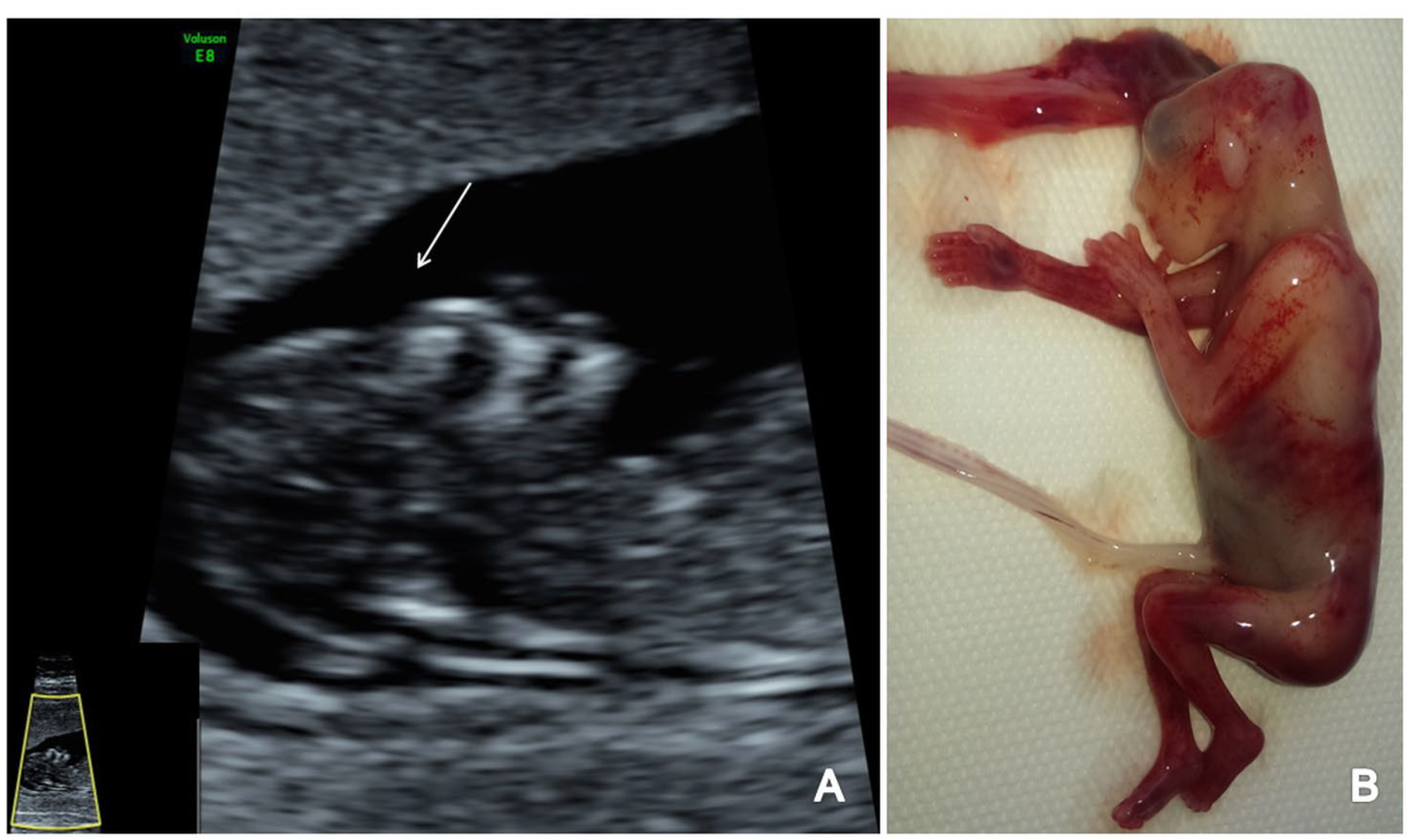 Brainsci 13 00118 g006