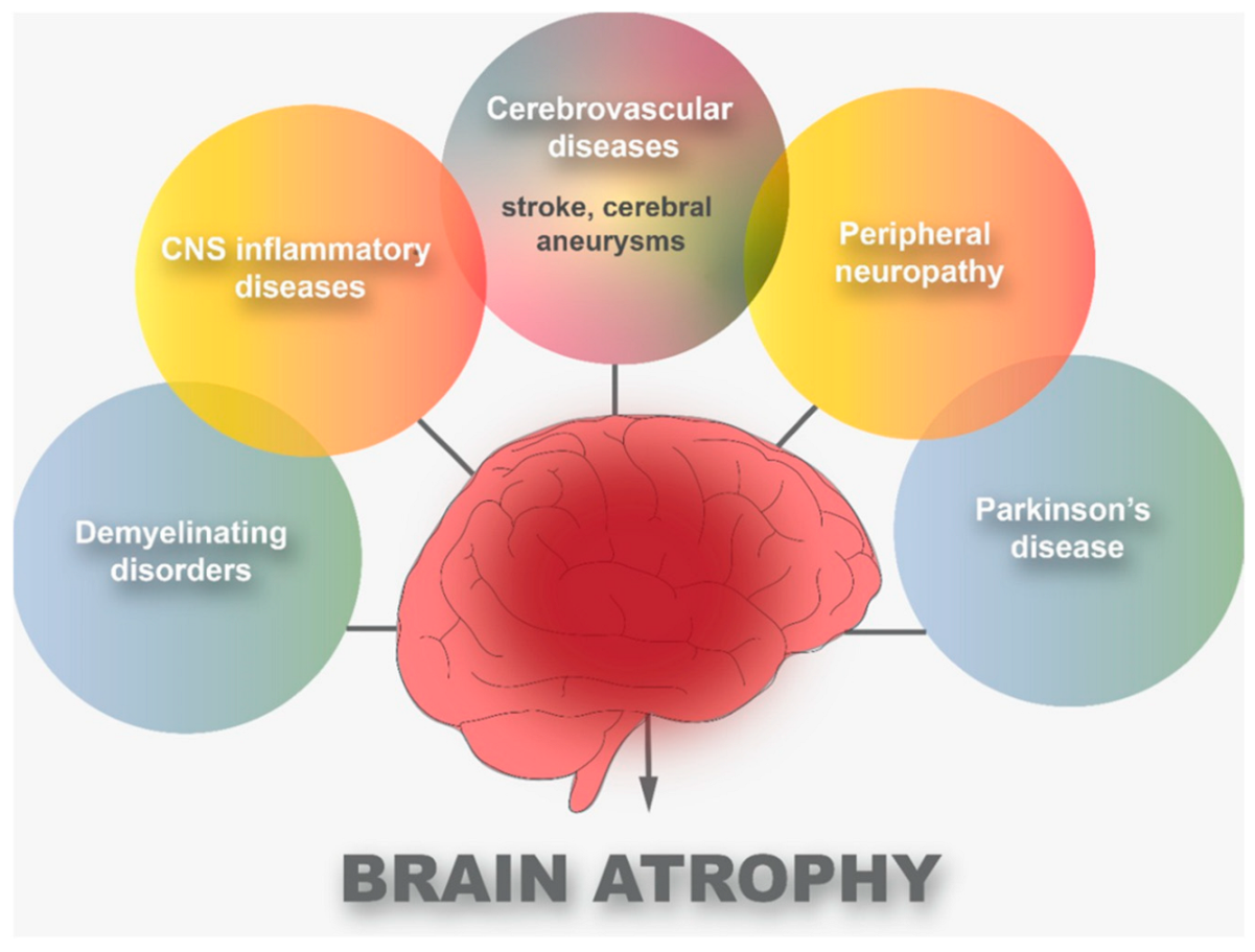 Brainsci 13 00131 g002