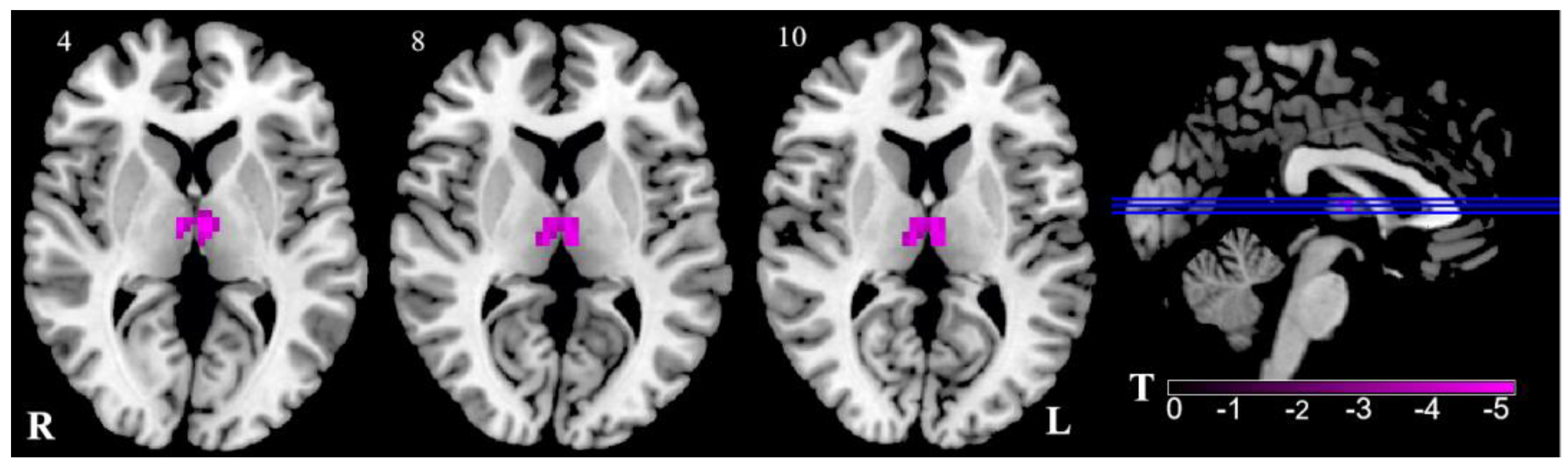 Brainsci 13 00183 g001 Brainsci 13 00183 g001