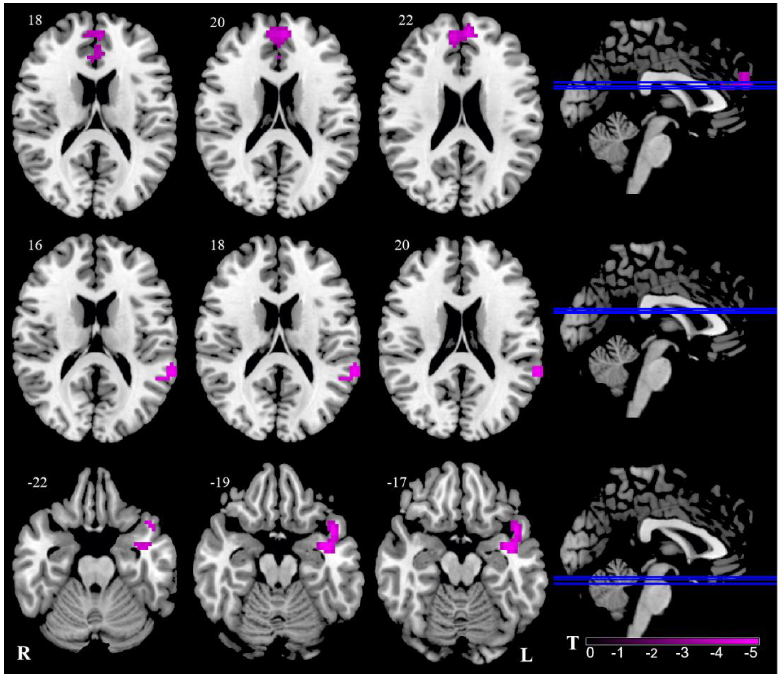 Brainsci 13 00183 g002 Brainsci 13 00183 g002