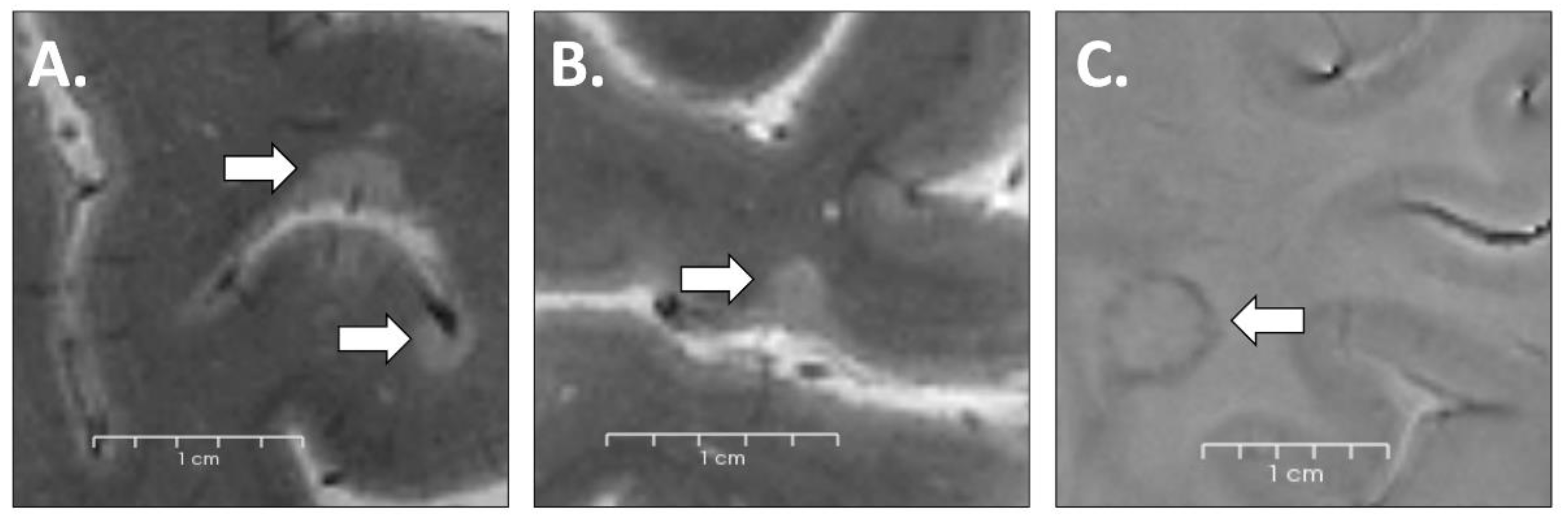 Brainsci 13 00198 g002