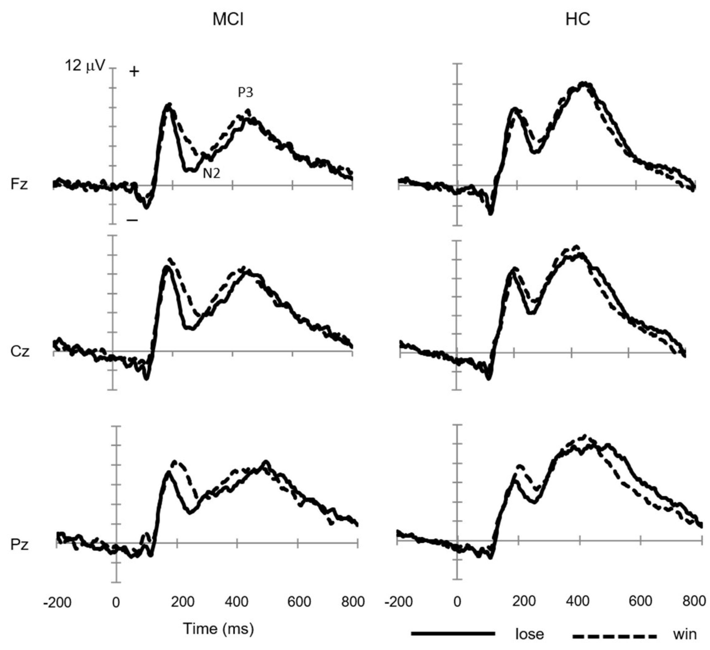 Brainsci 13 00203 g001