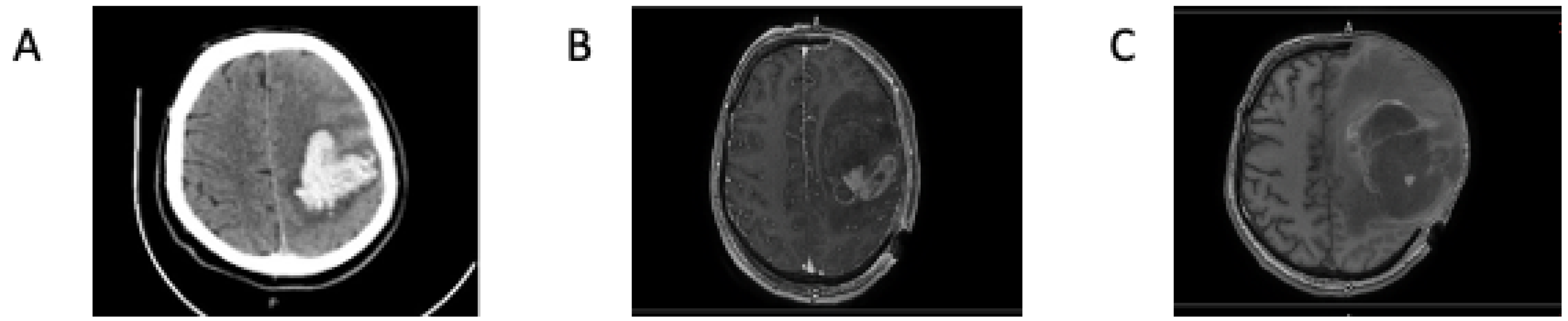 Brainsci 13 00235 g001 Brainsci 13 00235 g001