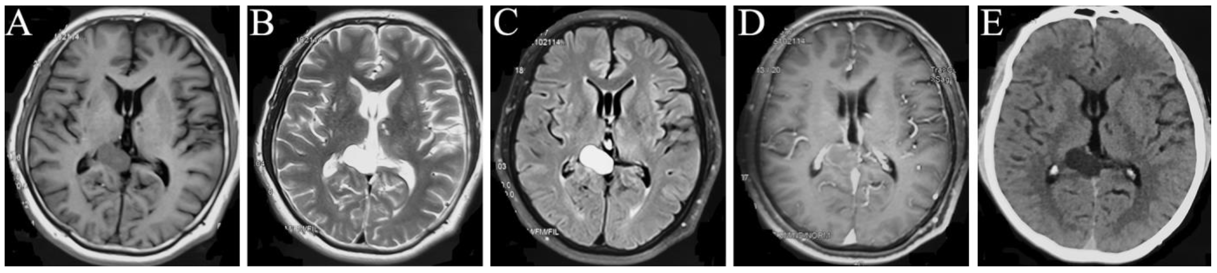 Brainsci 13 00239 g001