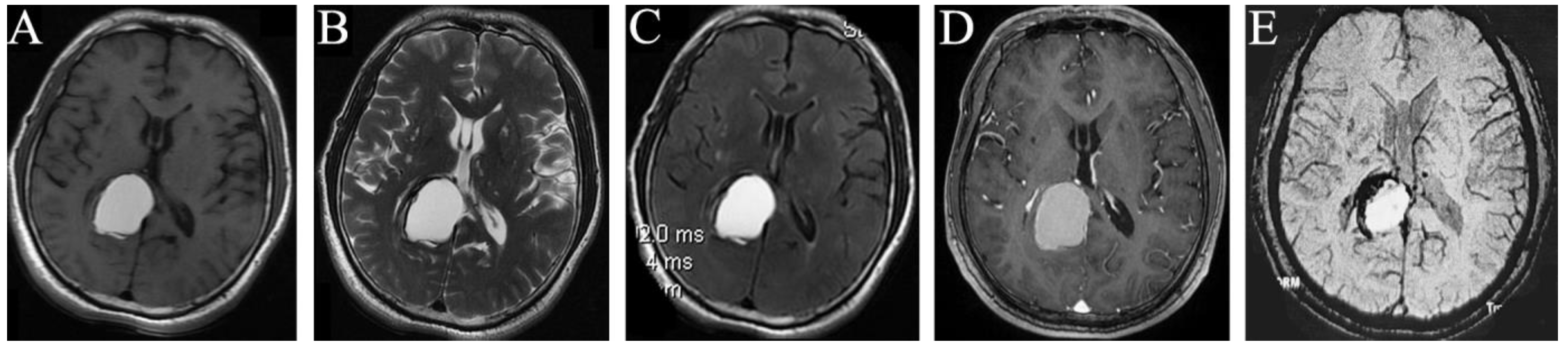 Brainsci 13 00239 g002