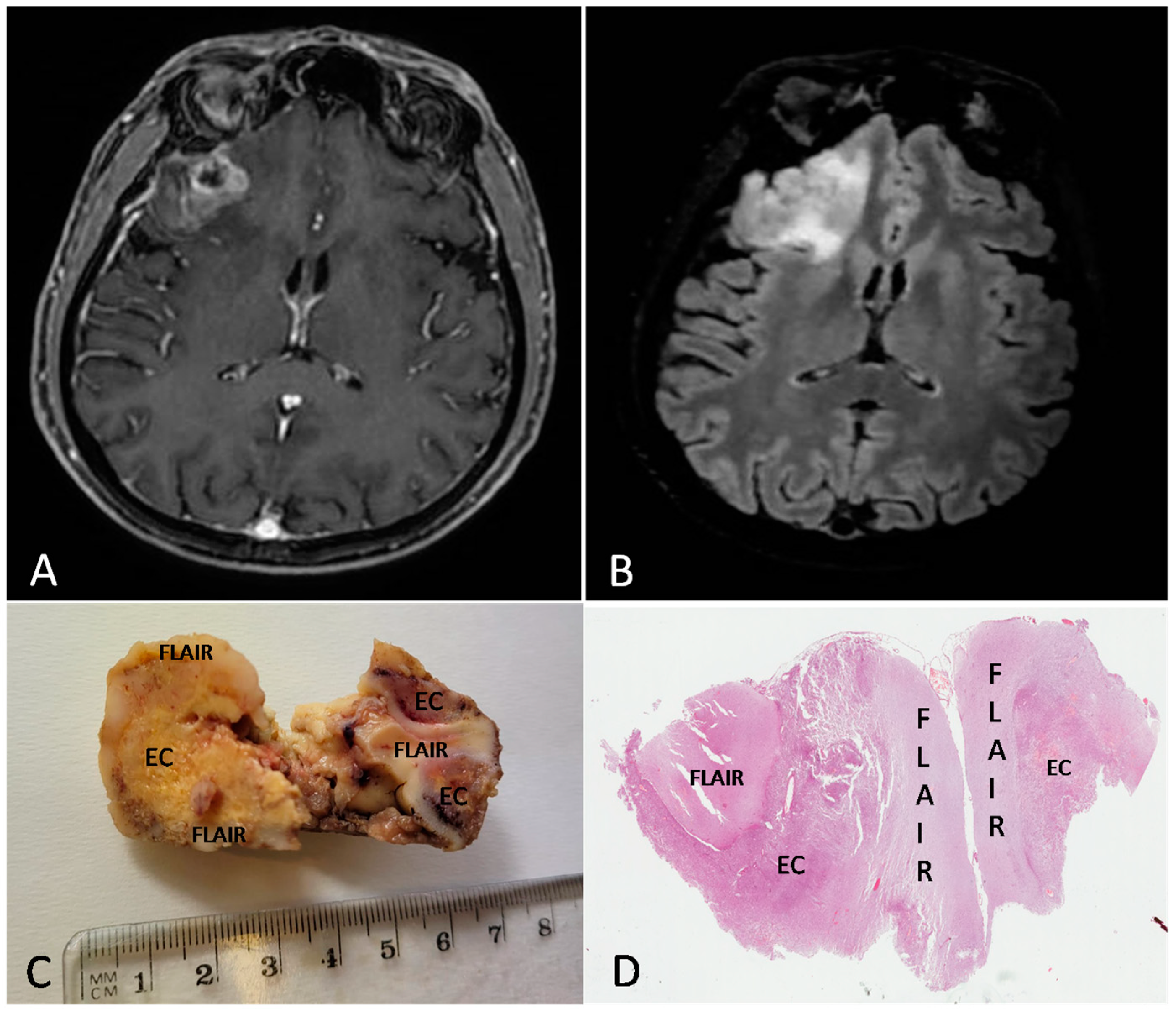 Brainsci 13 00248 g002