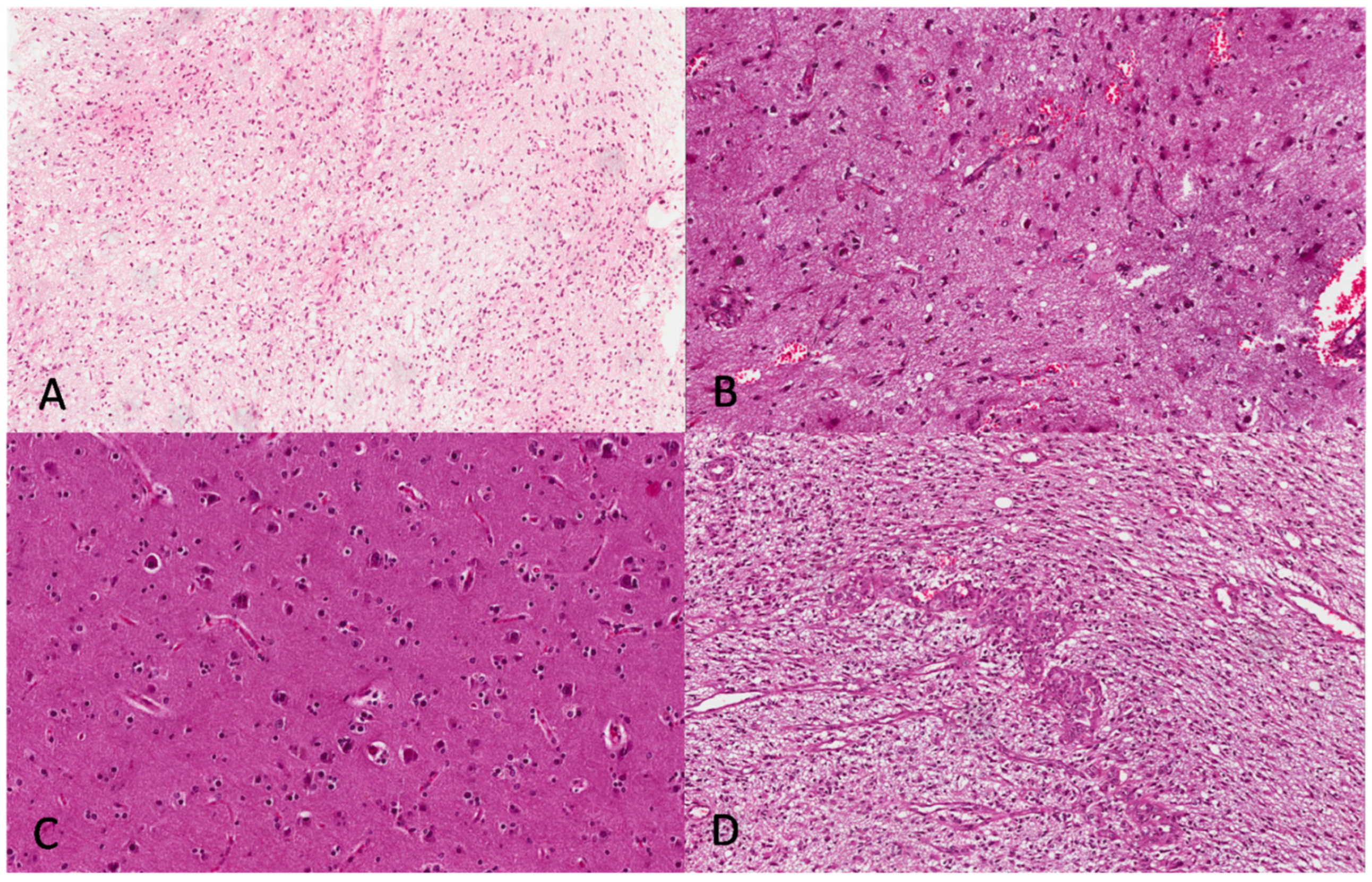 Brainsci 13 00248 g004