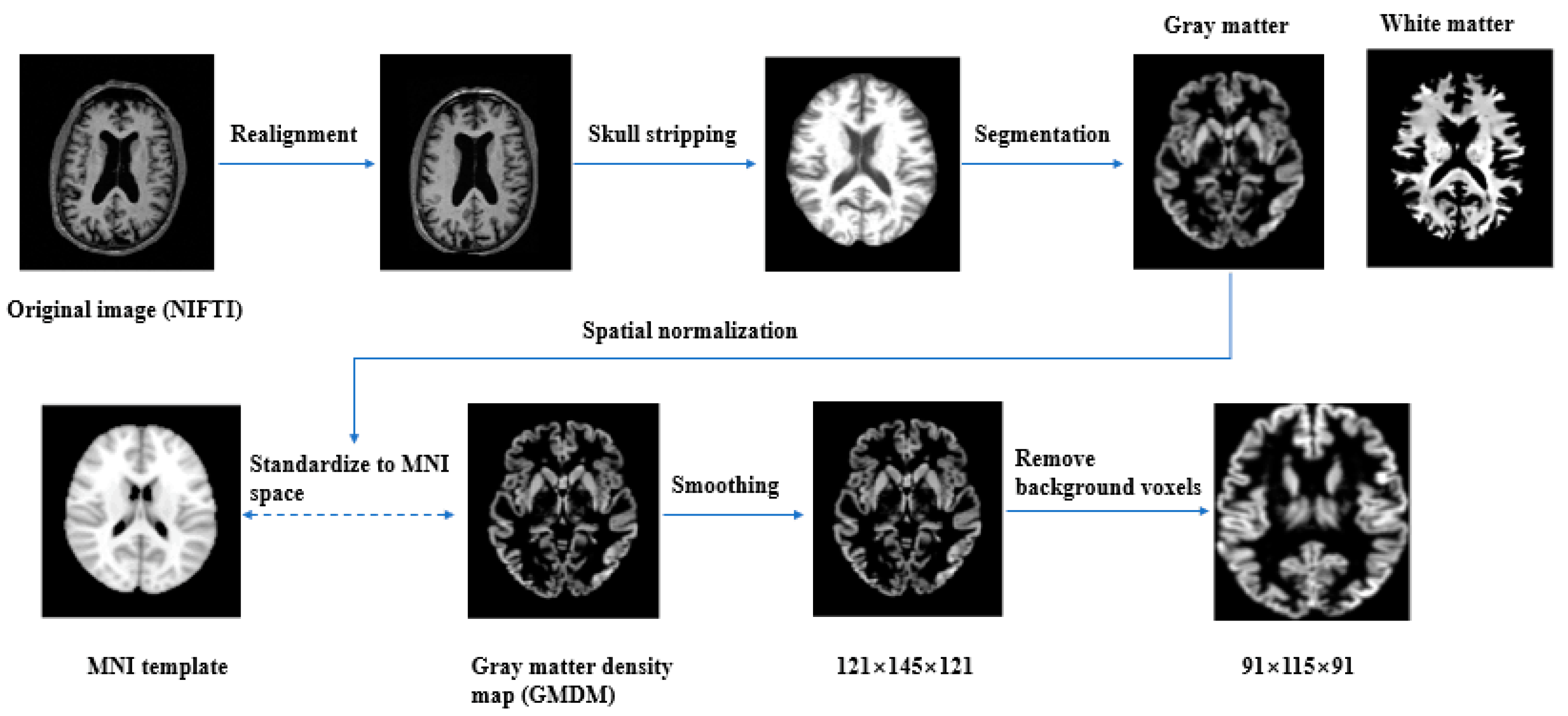 Brainsci 13 00254 g001 Brainsci 13 00254 g001
