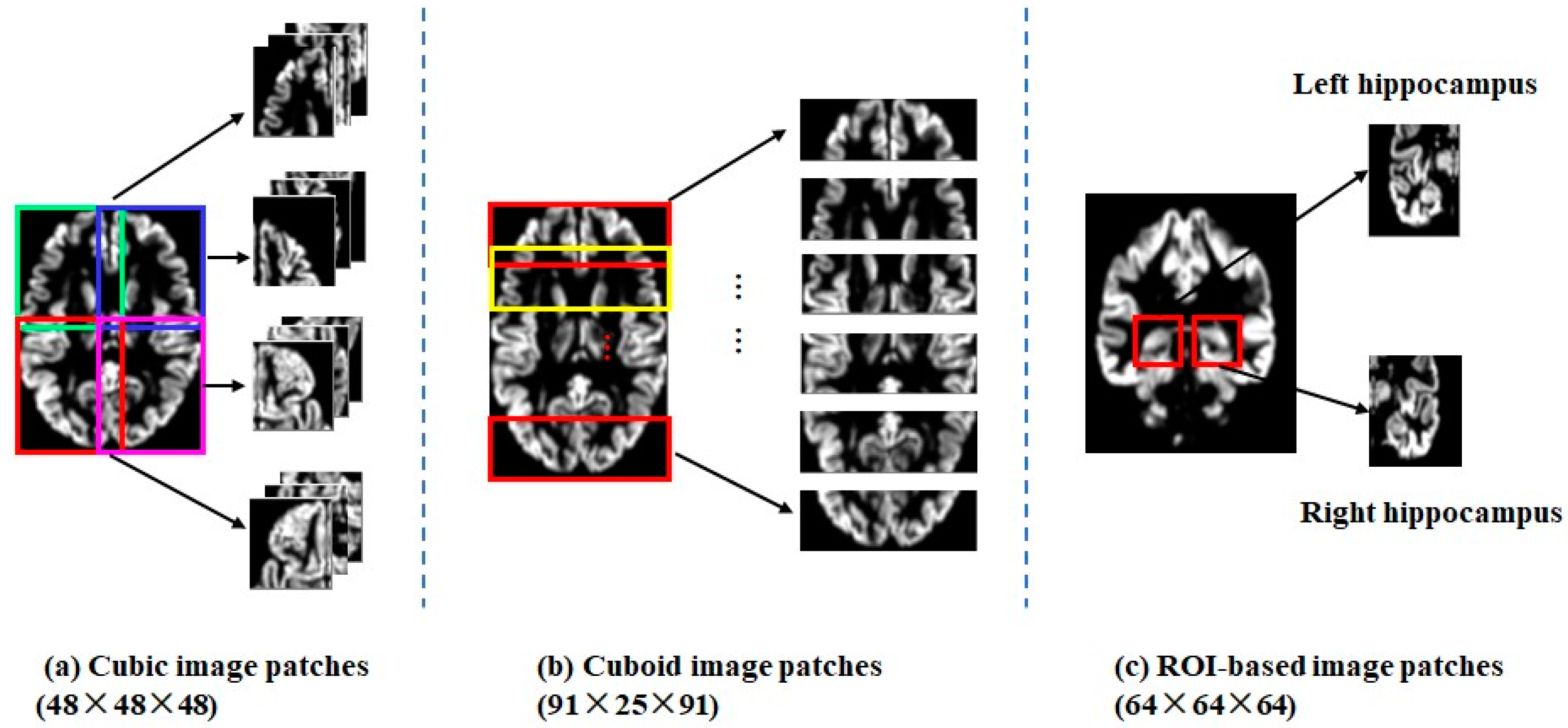 Brainsci 13 00254 g002 Brainsci 13 00254 g002