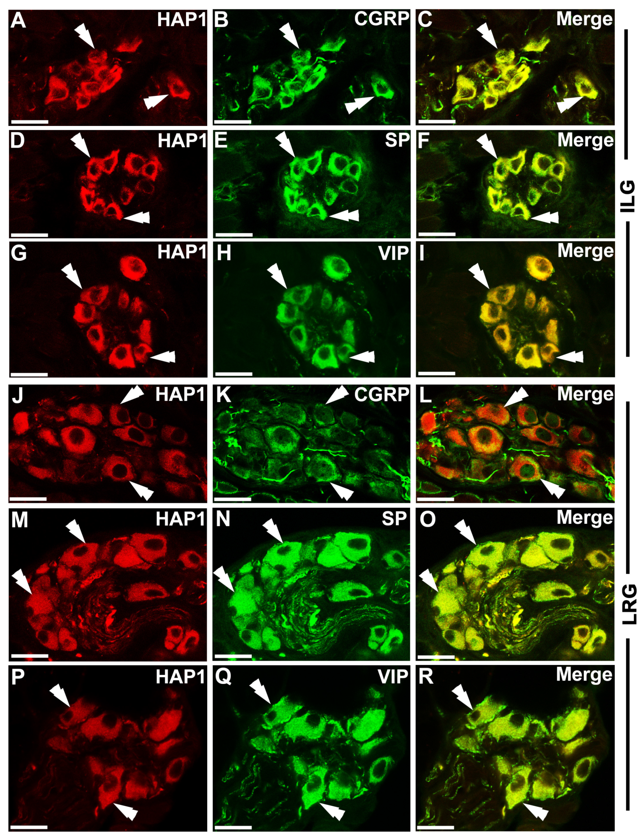 Brainsci 13 00258 g004