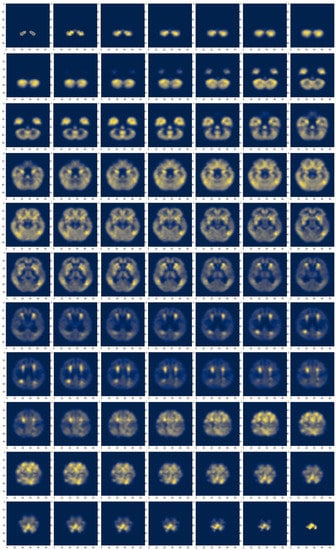 Brainsci 13 00260 g0a3