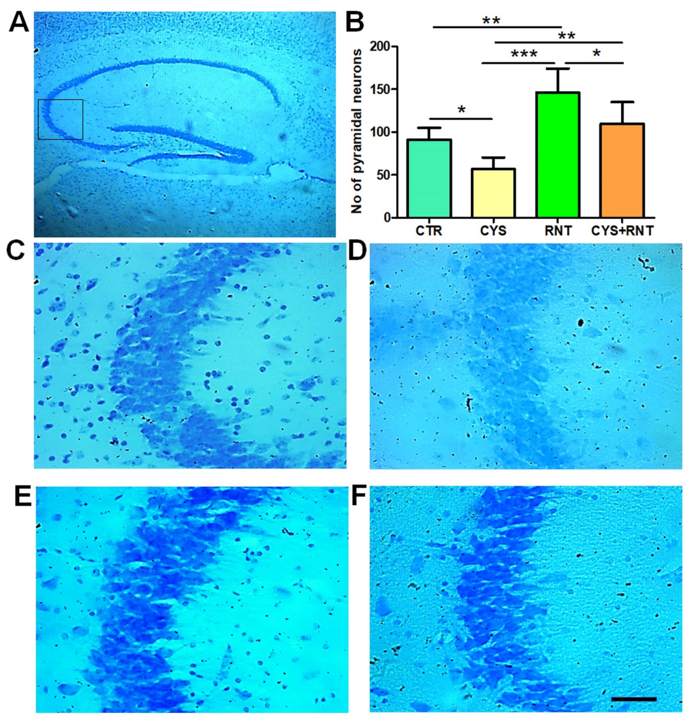 Brainsci 13 00266 g006