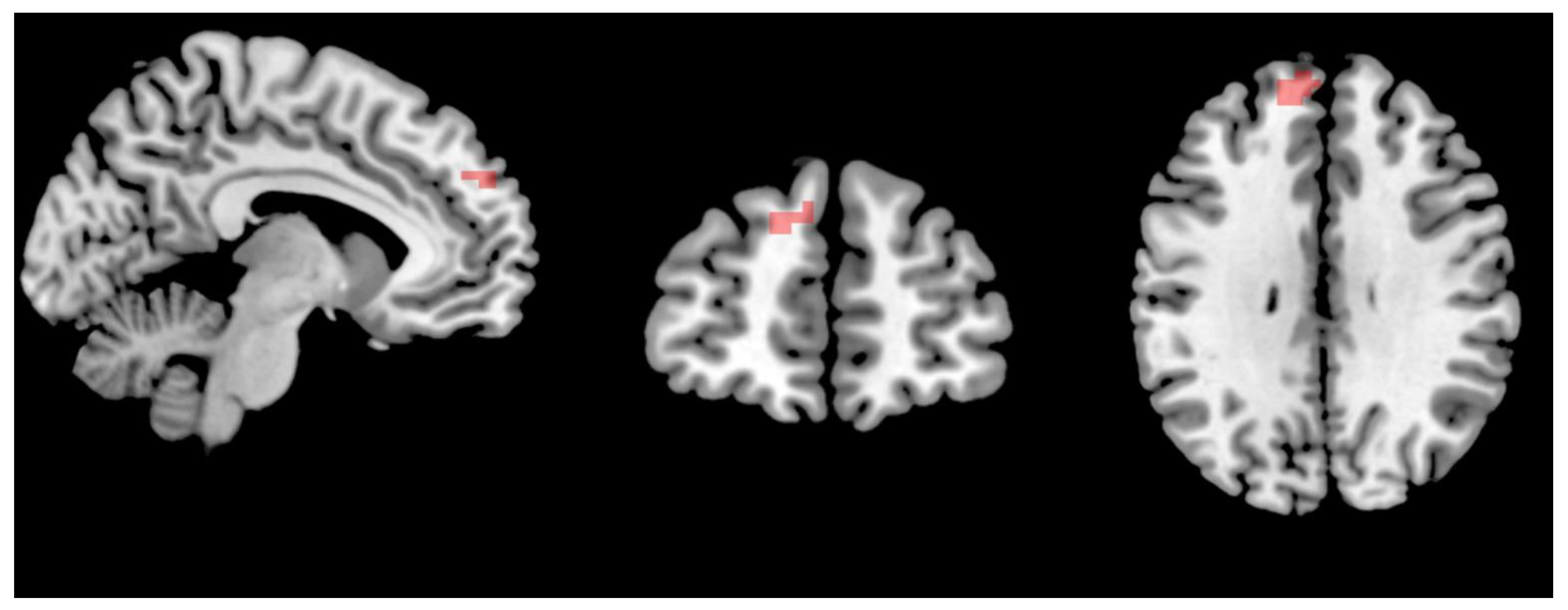 Brainsci 13 00274 g003