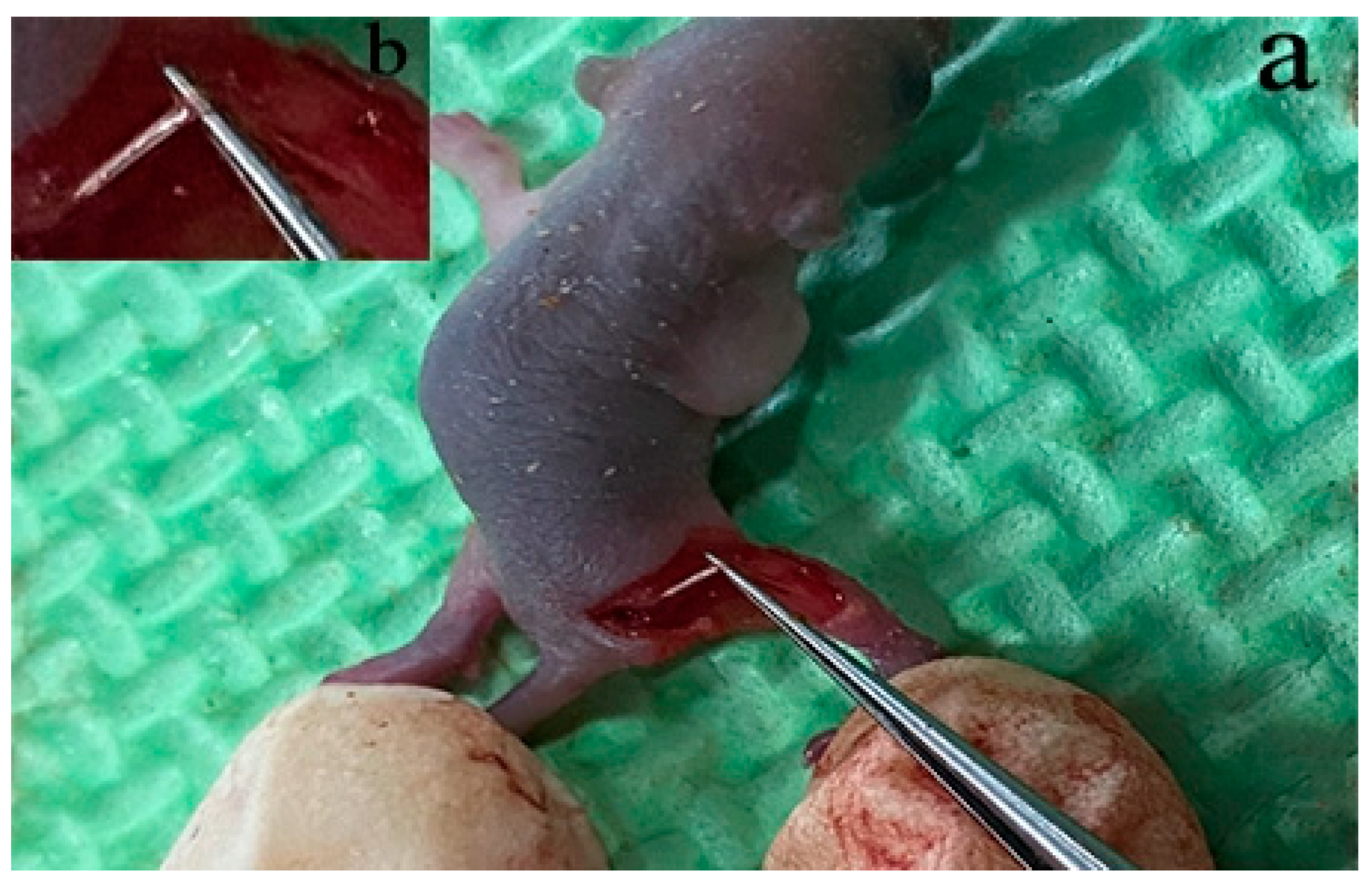 Brainsci 13 00281 g004