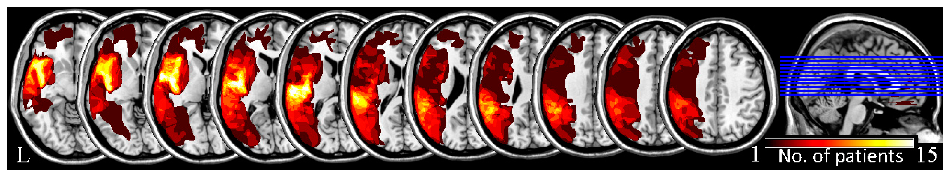 Brainsci 13 00300 g001
