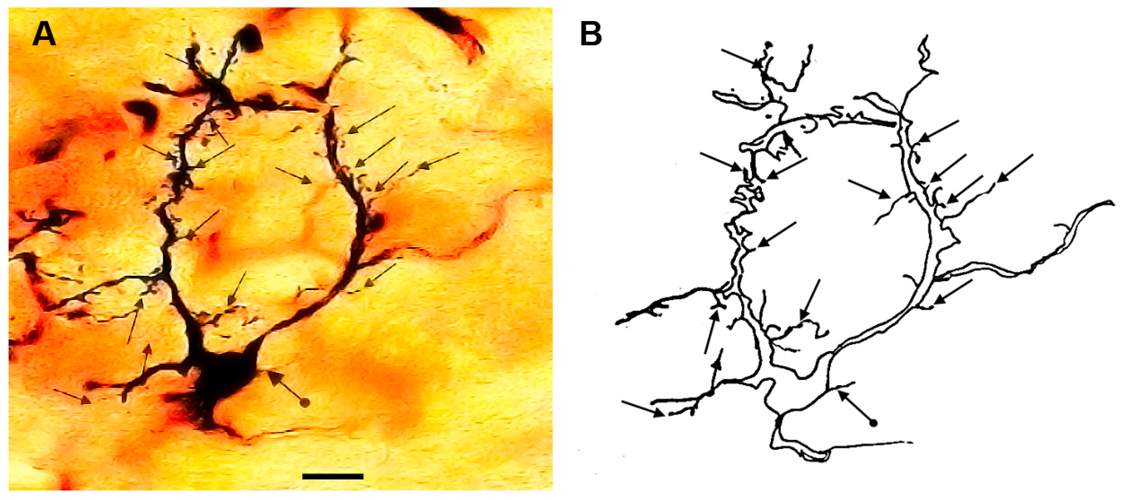 Brainsci 13 00312 g002
